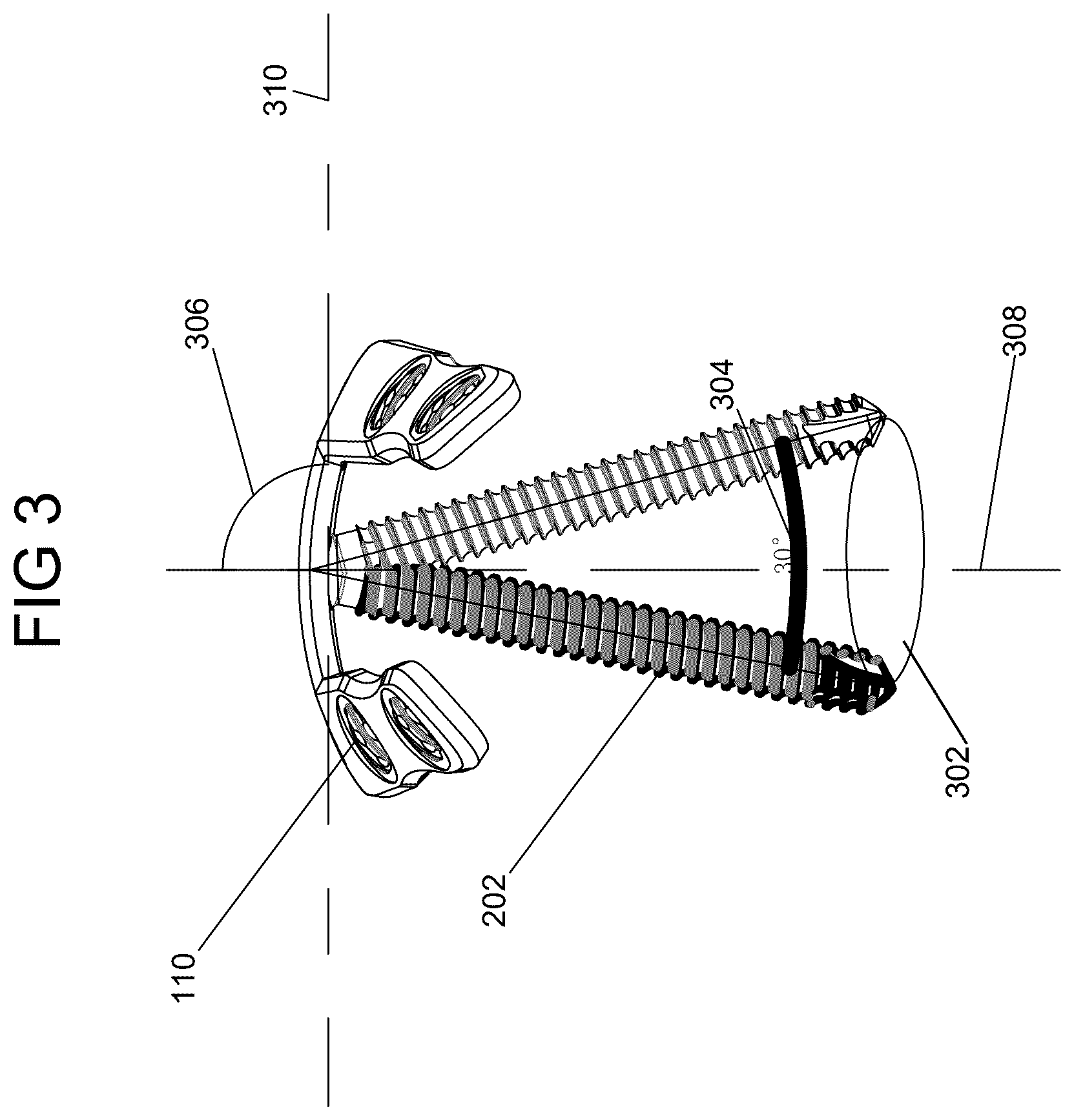 Patent US12588932 Figure 3 – Multi-planar fixation system