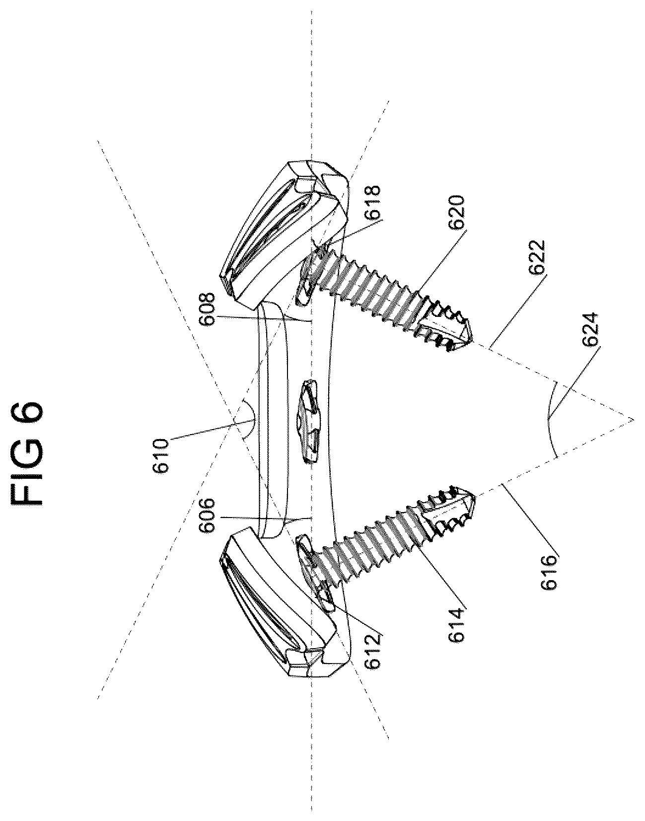 Patent US12588932 Figure 7 – Multi-planar fixation system