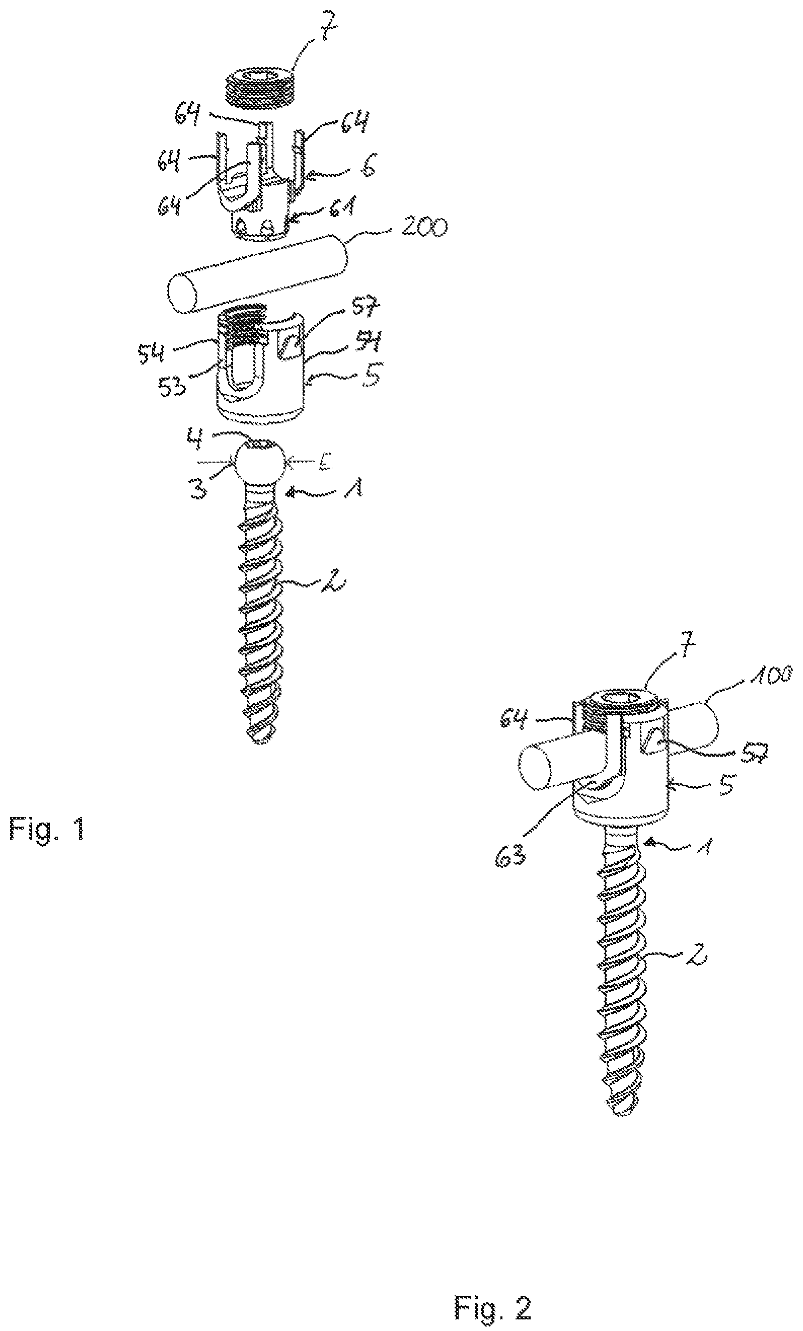 Patent US12588933 Figure 1 – Coupling device for coupling a rod to a bone anchor