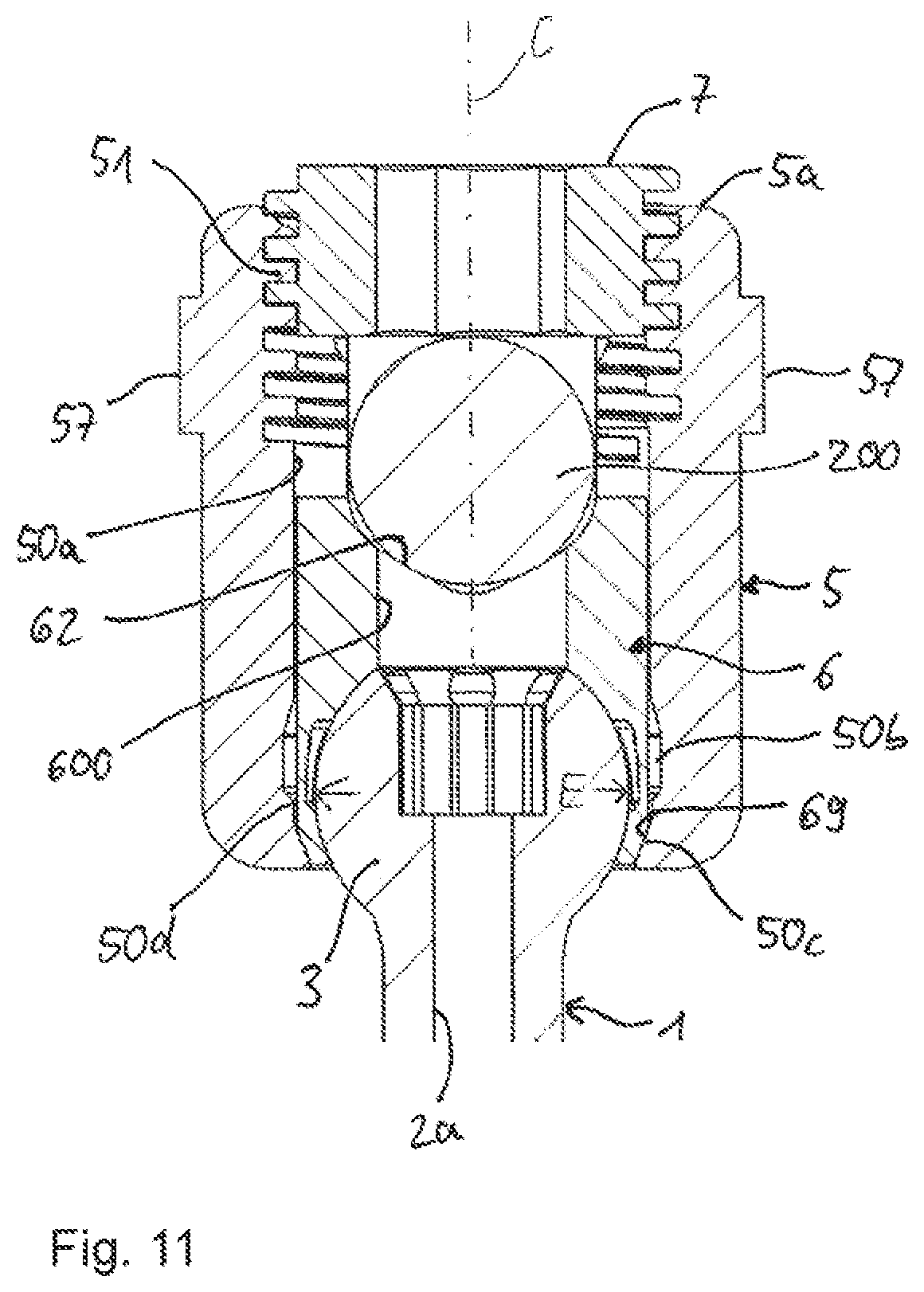 Patent US12588933 Figure 4 – Coupling device for coupling a rod to a bone anchor