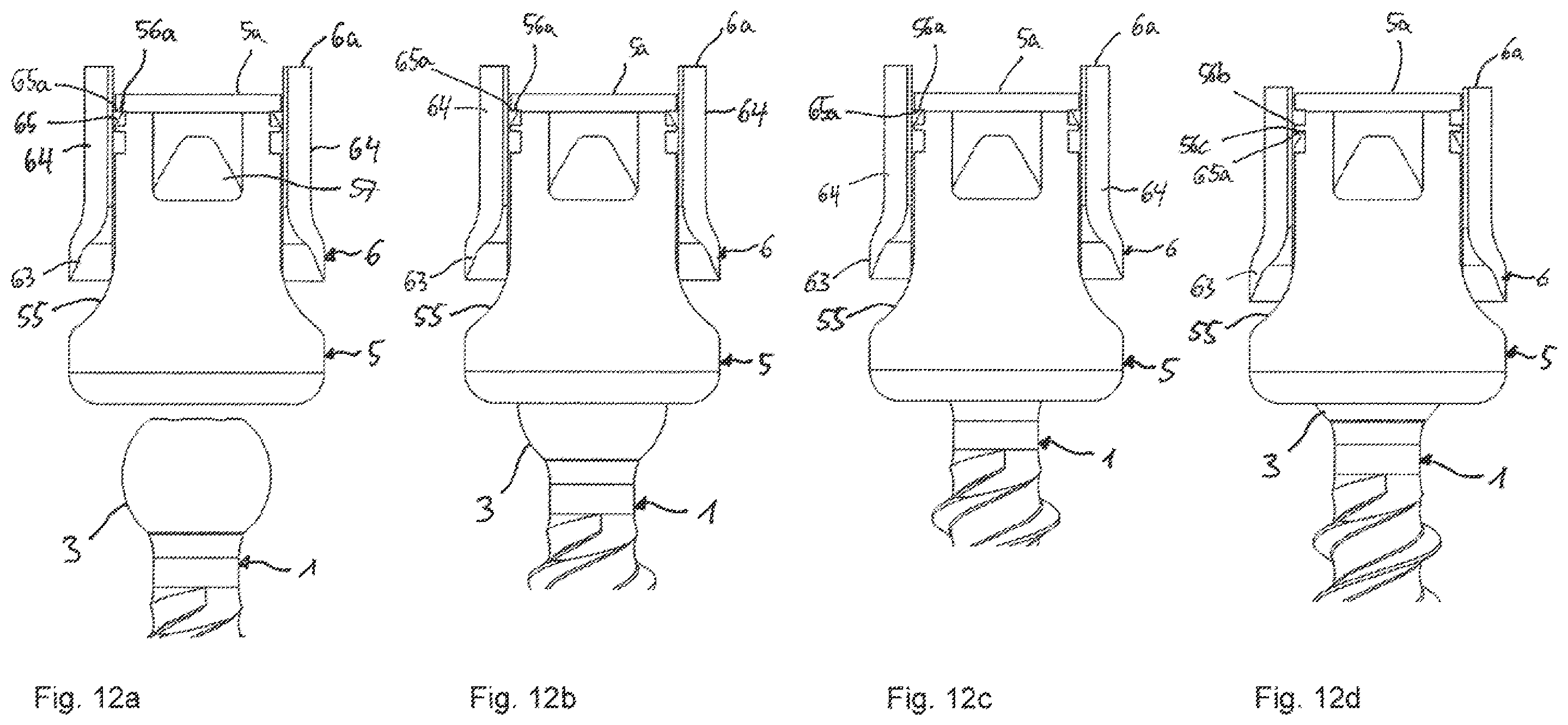 Patent US12588933 Figure 5 – Coupling device for coupling a rod to a bone anchor