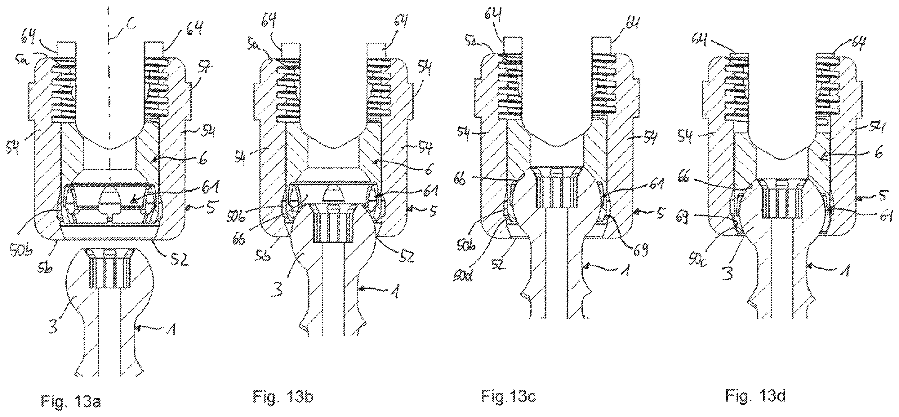 Patent US12588933 Figure 6 – Coupling device for coupling a rod to a bone anchor