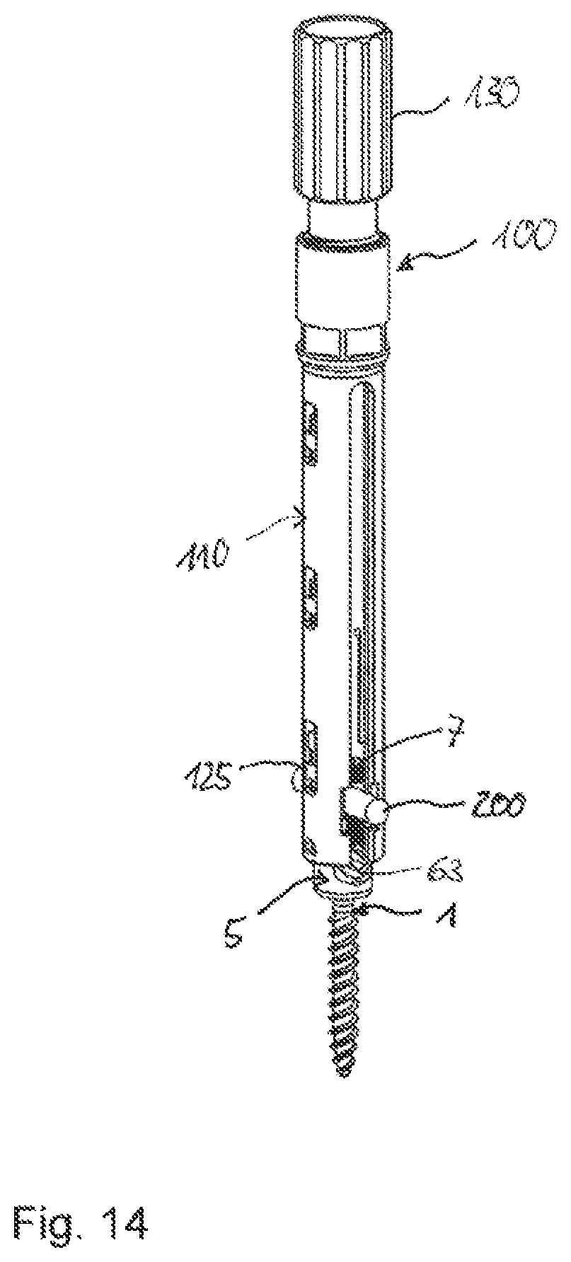 Patent US12588933 Figure 7 – Coupling device for coupling a rod to a bone anchor