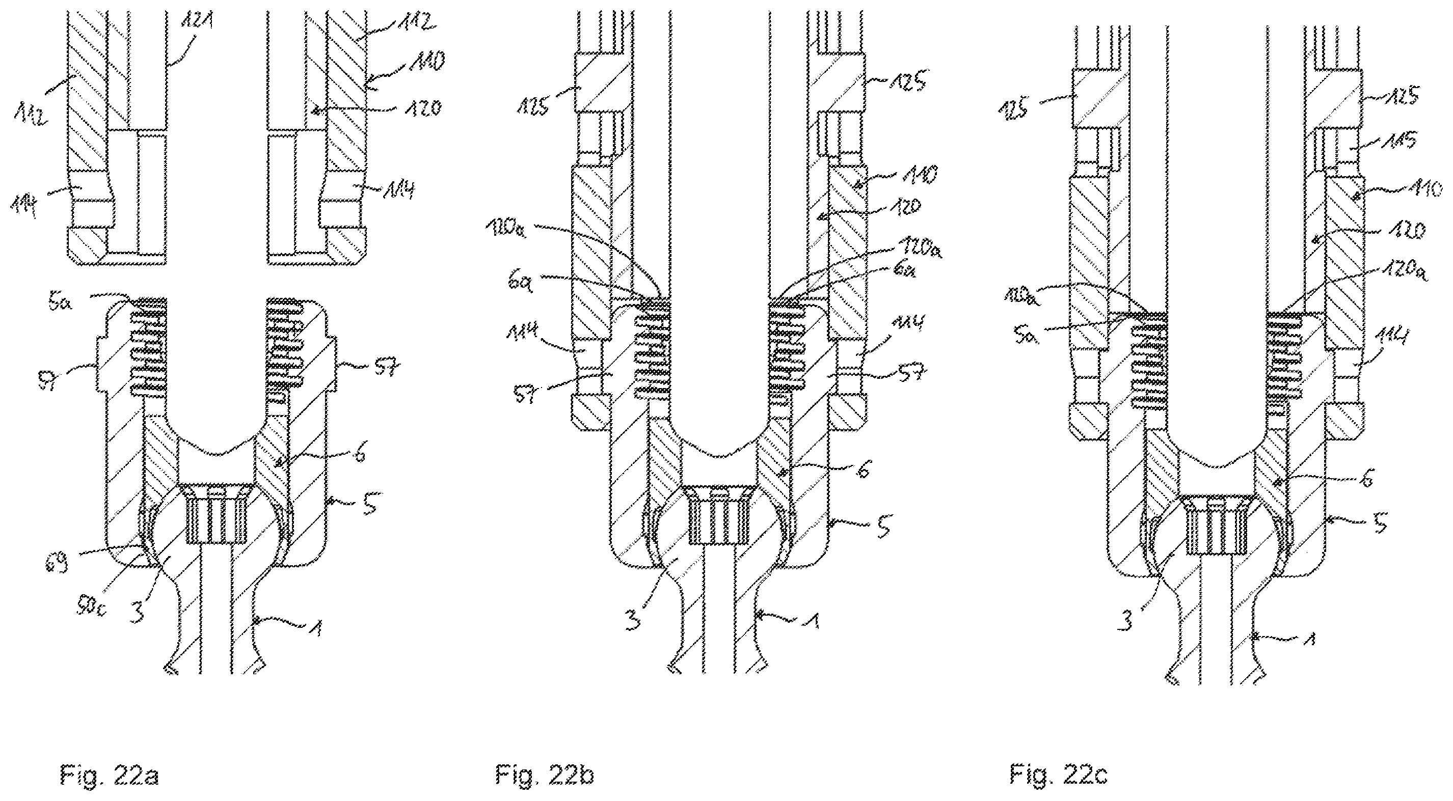 Patent US12588933 Figure 11 – Coupling device for coupling a rod to a bone anchor