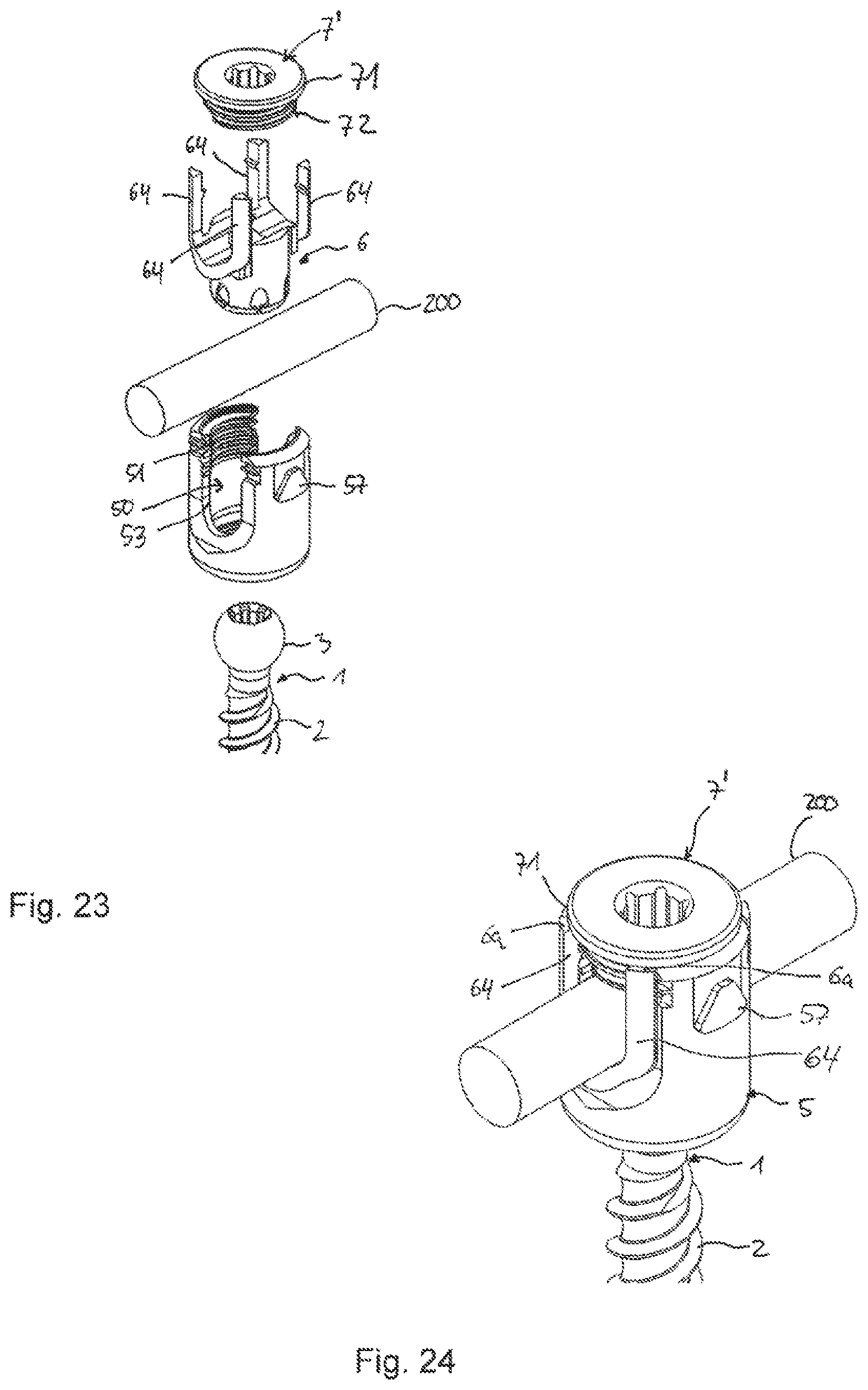 Patent US12588933 Figure 12 – Coupling device for coupling a rod to a bone anchor