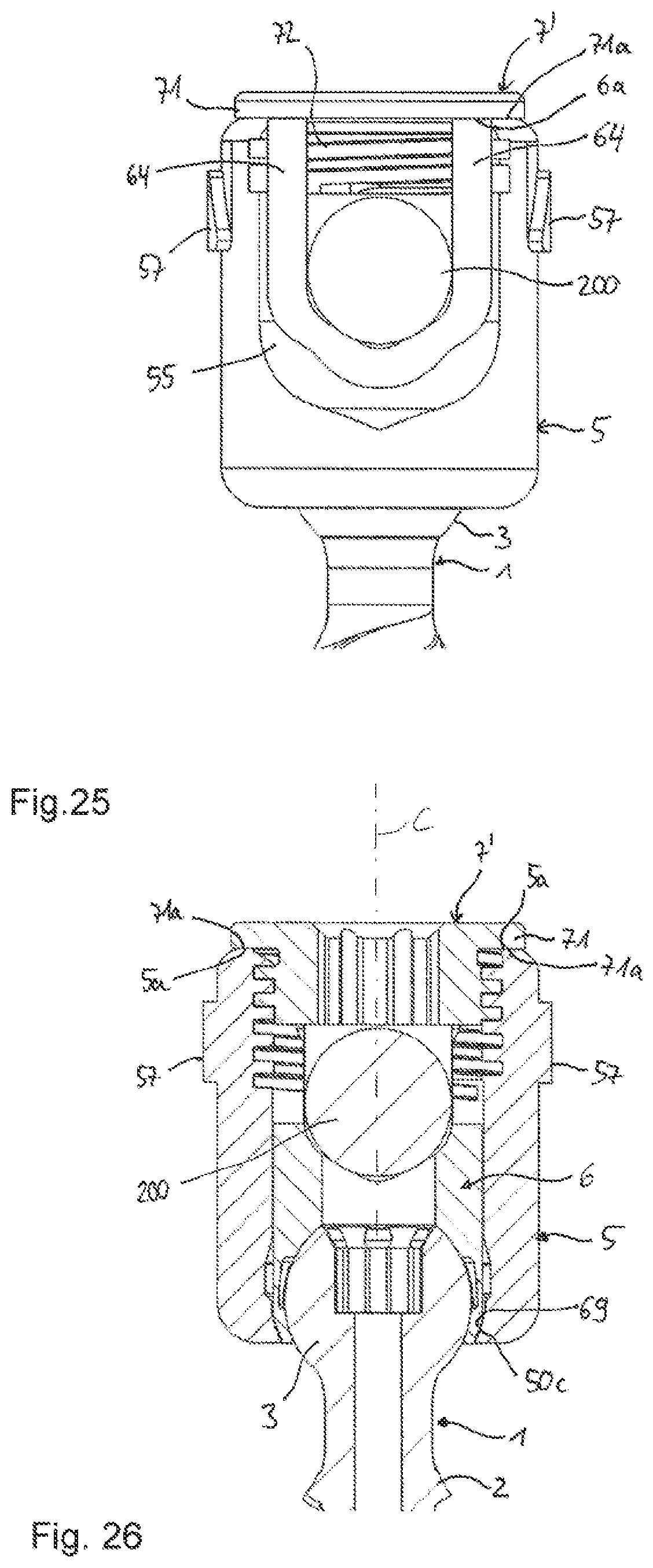 Patent US12588933 Figure 13 – Coupling device for coupling a rod to a bone anchor