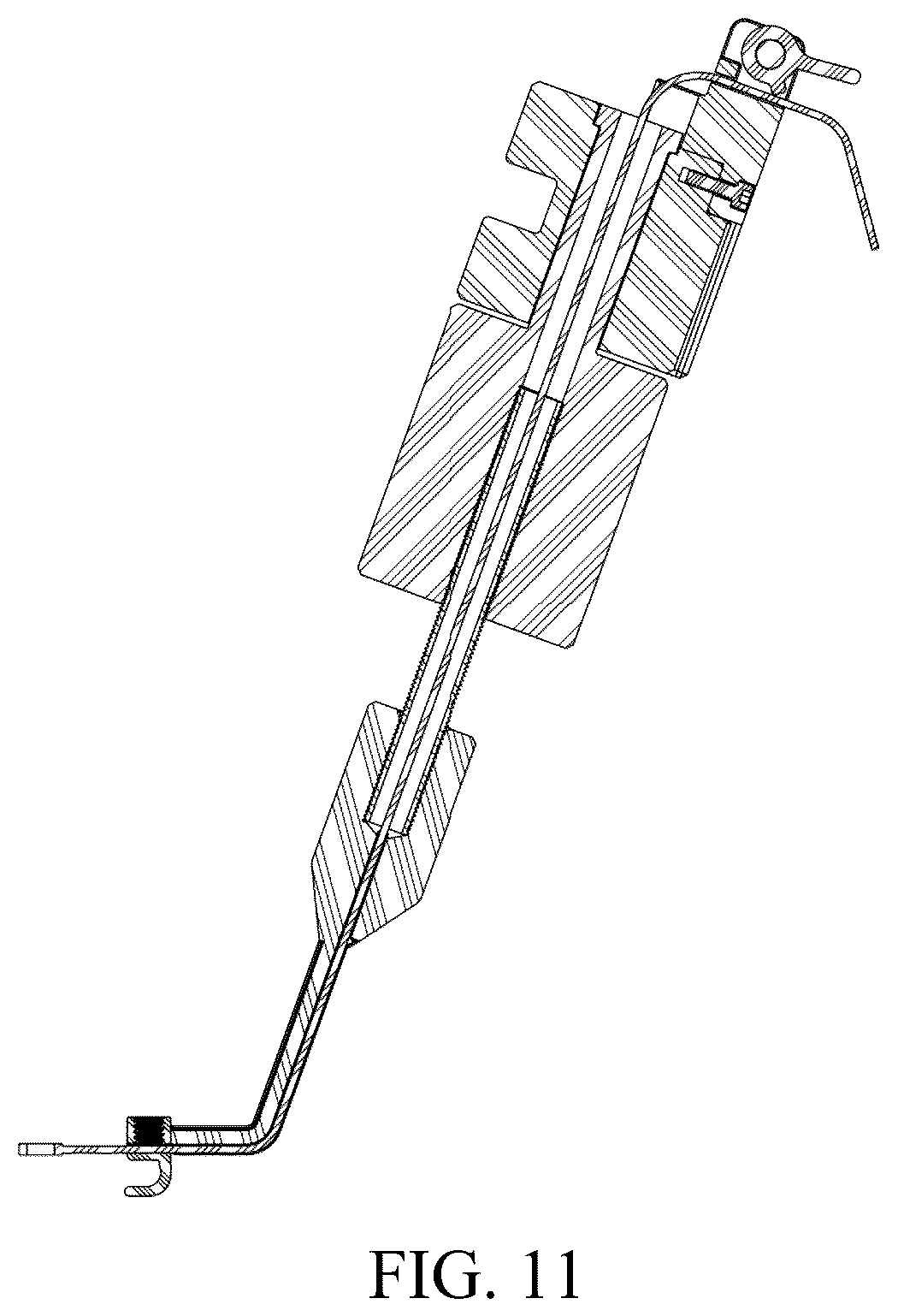 Patent US12588934 Figure 6 – Lumbar spondylolysis fracture fixation system