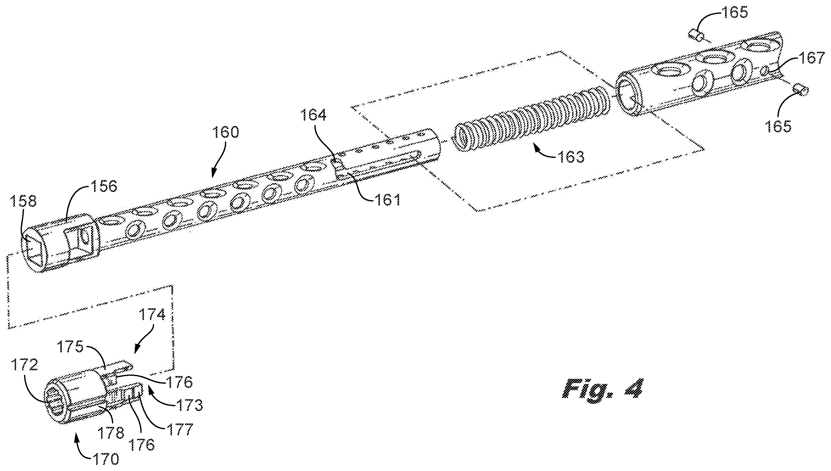 Patent US12588935 Figure 3 – Interspinous implant insertion instrument with staggered path implant deployment mechanism