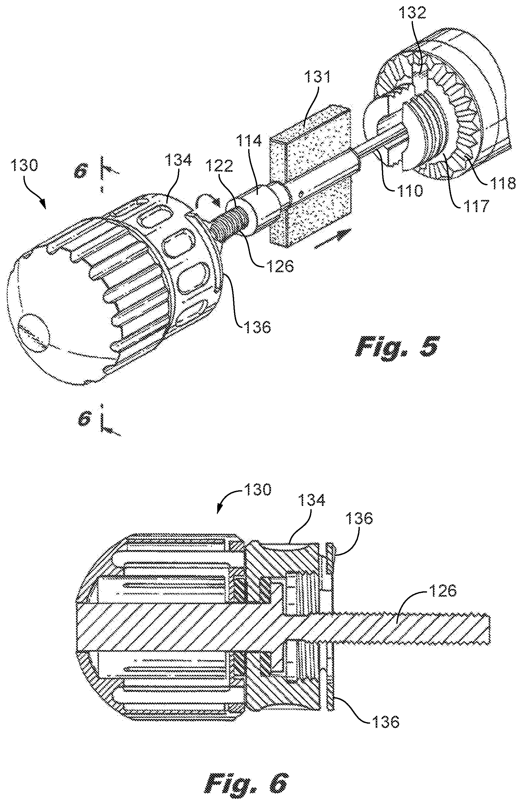 Patent US12588935 Figure 4 – Interspinous implant insertion instrument with staggered path implant deployment mechanism