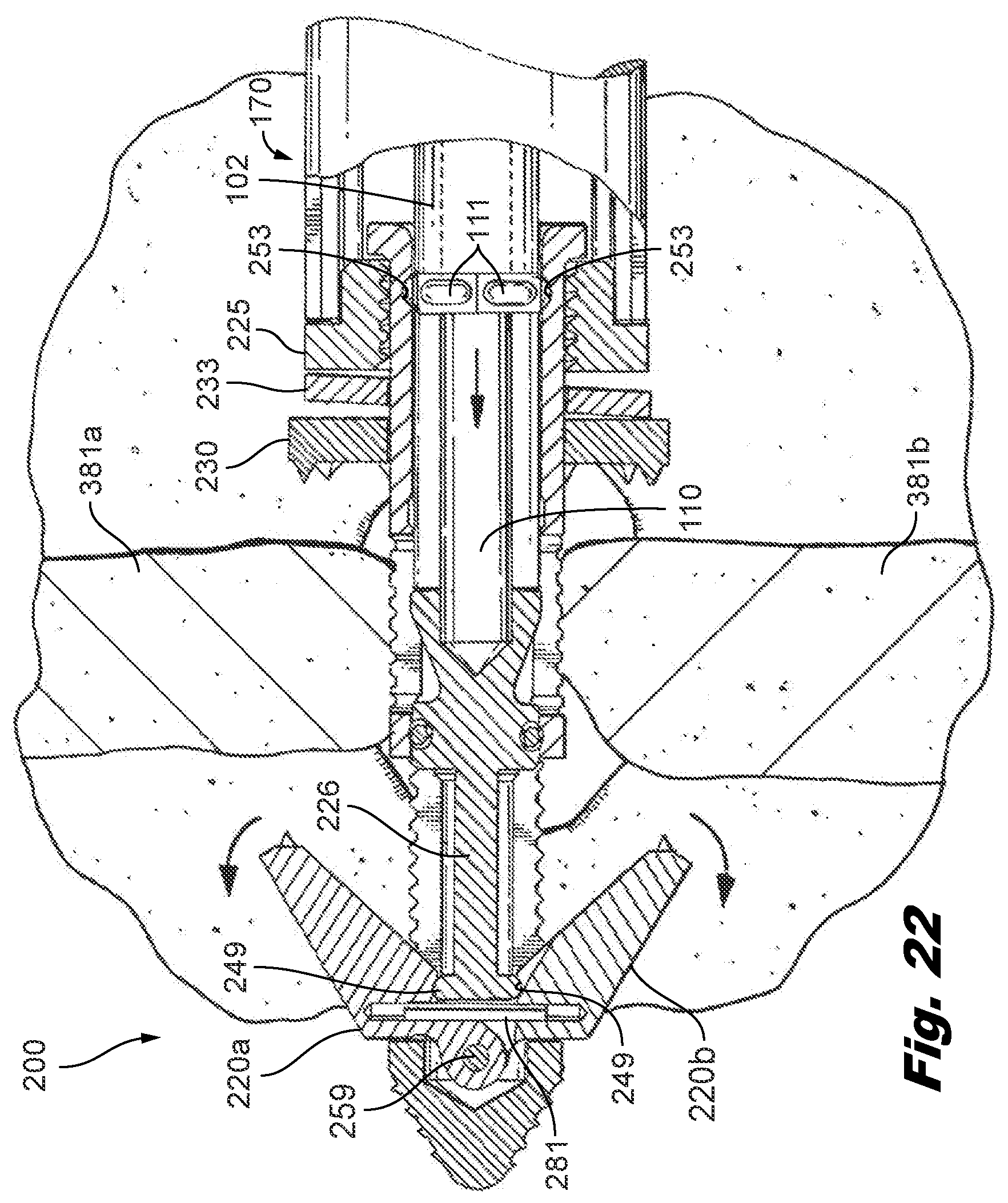 Patent US12588935 Figure 13 – Interspinous implant insertion instrument with staggered path implant deployment mechanism