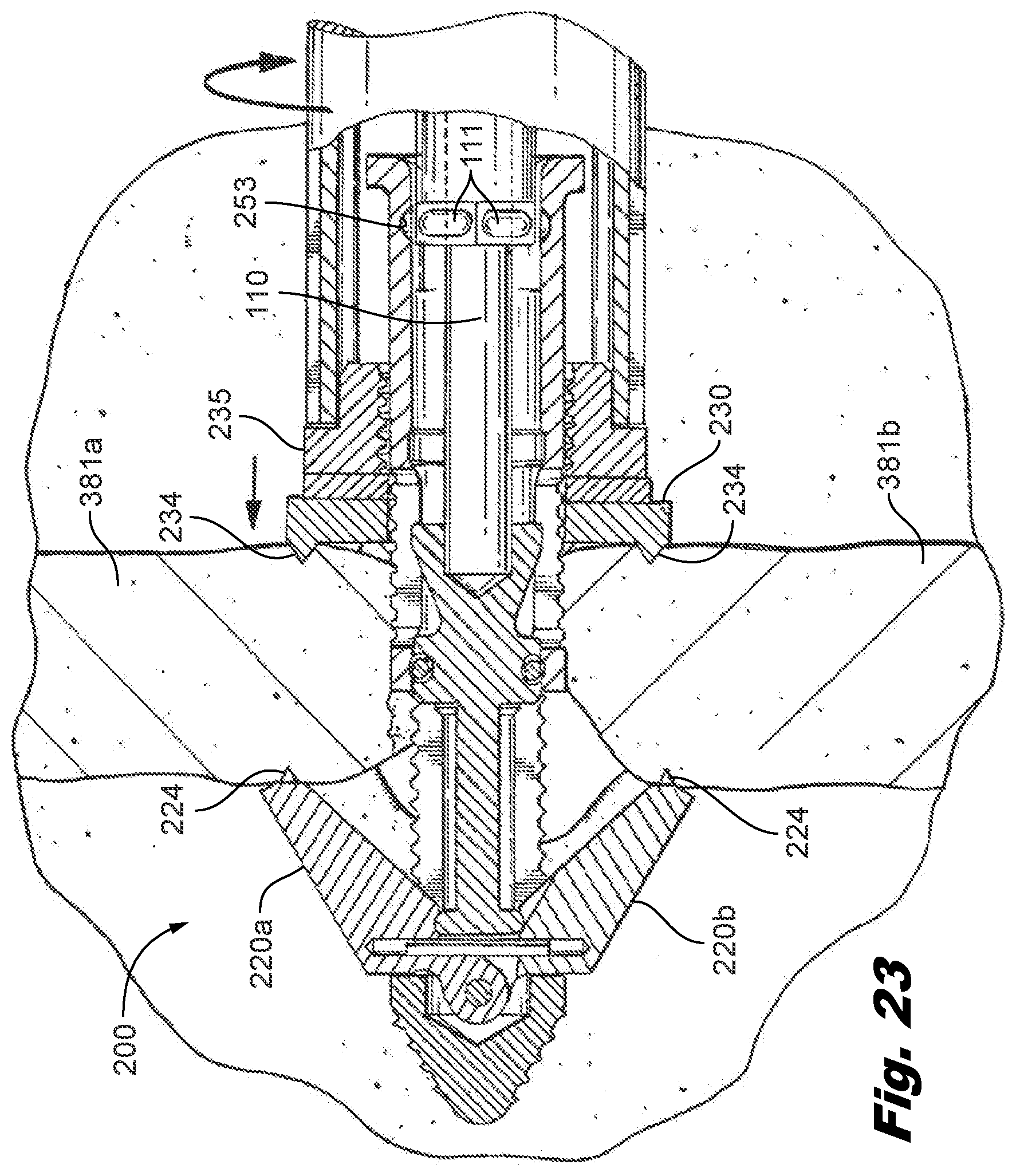 Patent US12588935 Figure 14 – Interspinous implant insertion instrument with staggered path implant deployment mechanism