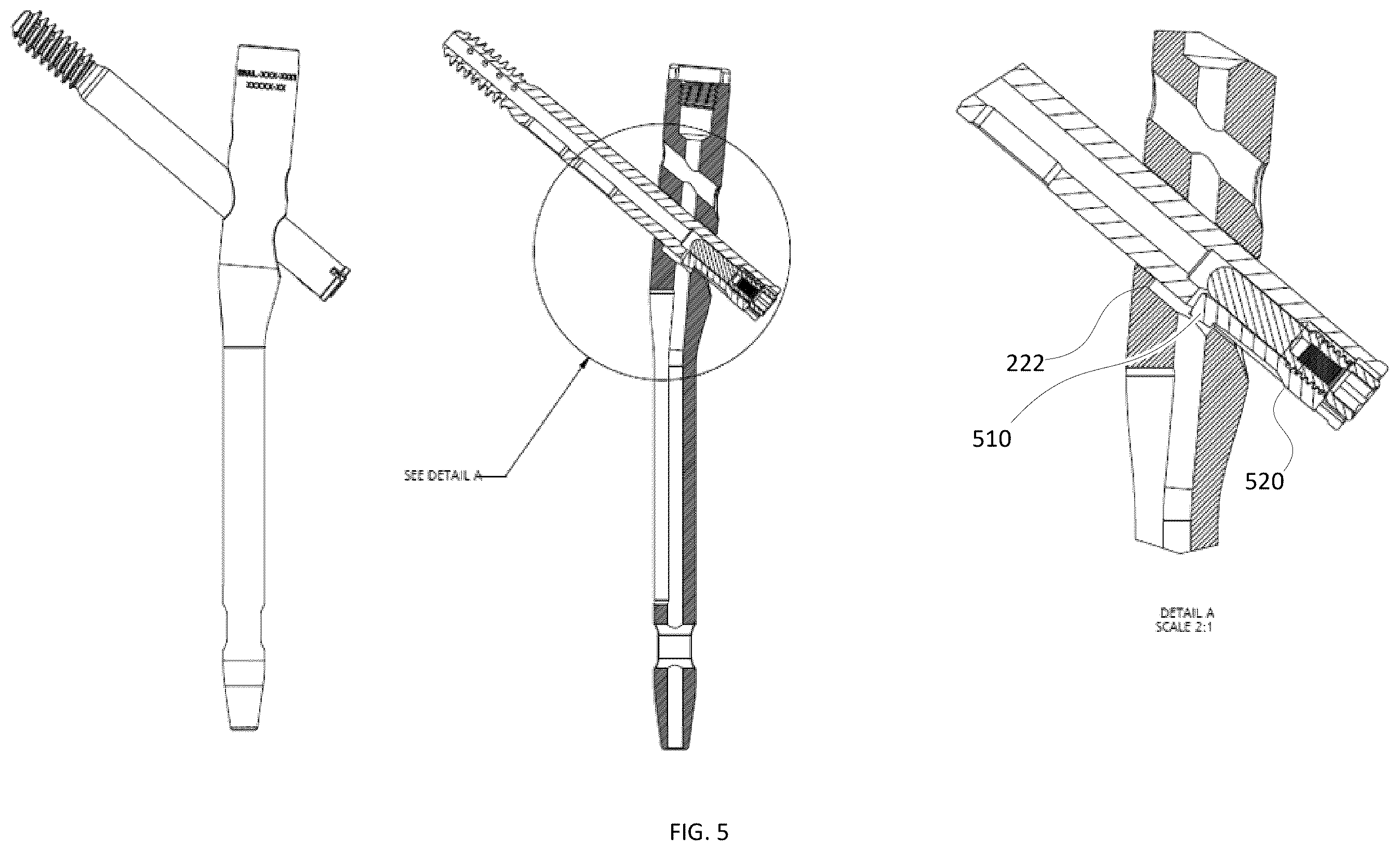 Patent US12588936 Figure 5 – Lag screw systems and nail systems and methods incorporating the same