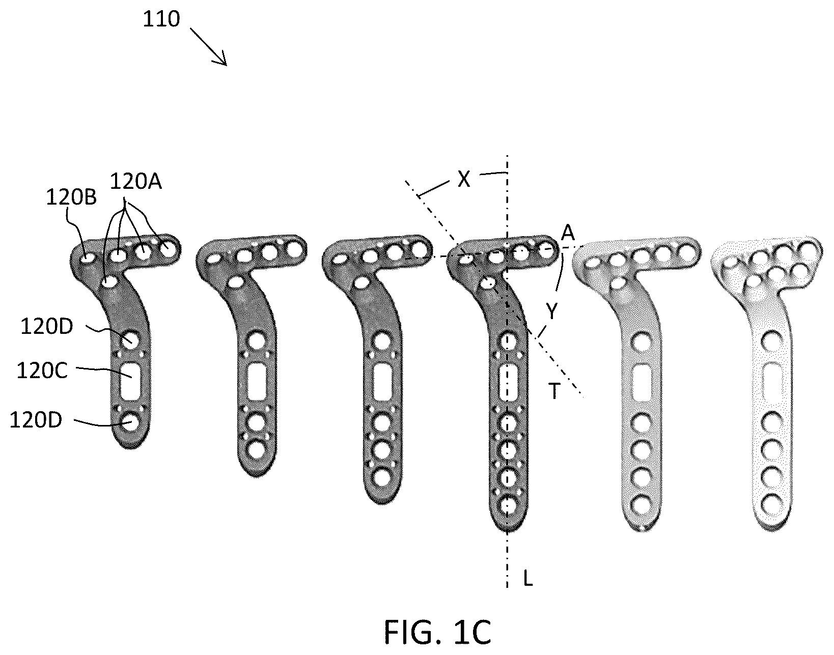 Patent US12588937 Figure 2 – Volar distal radius stabilization system