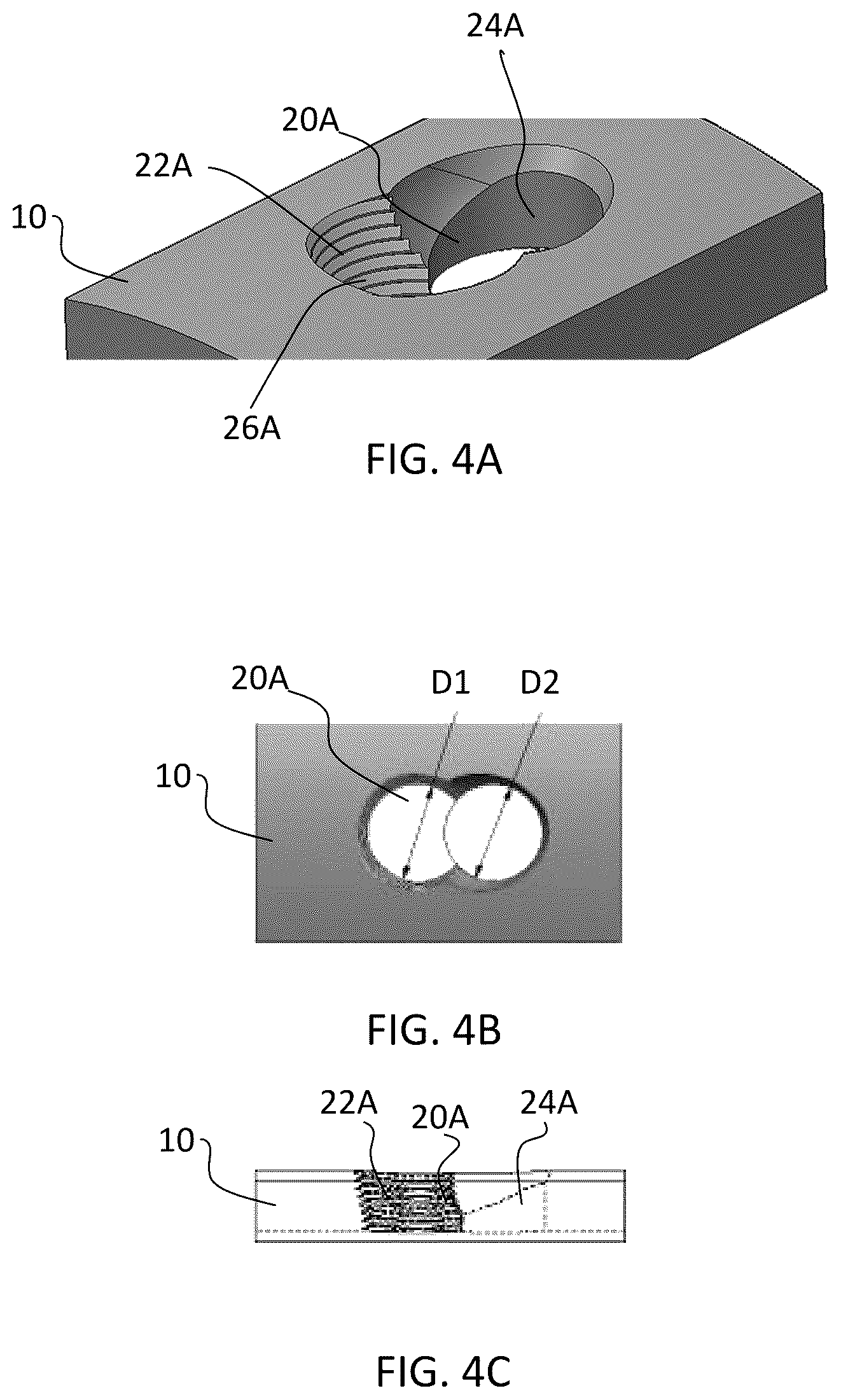 Patent US12588937 Figure 6 – Volar distal radius stabilization system