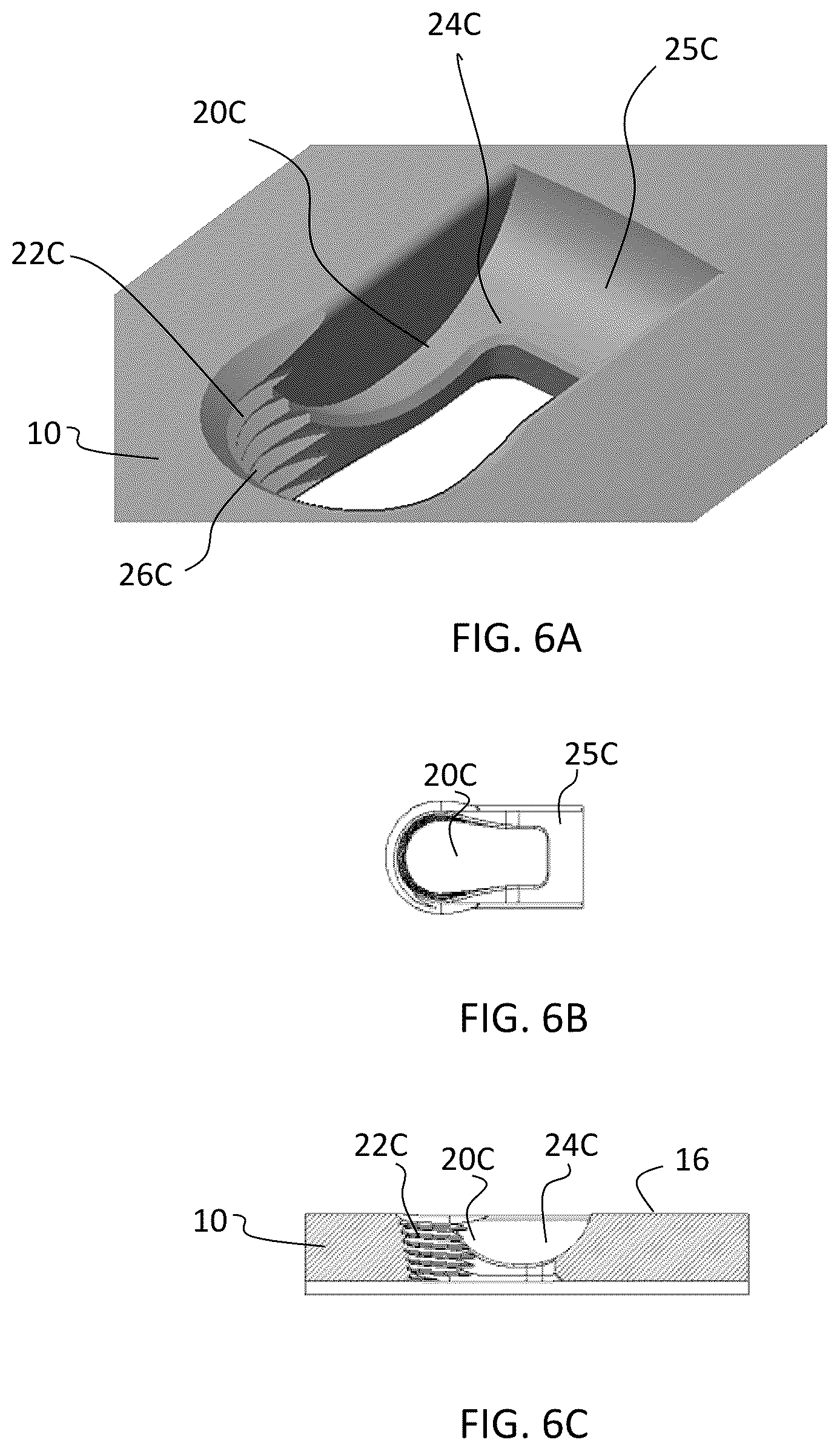 Patent US12588937 Figure 8 – Volar distal radius stabilization system