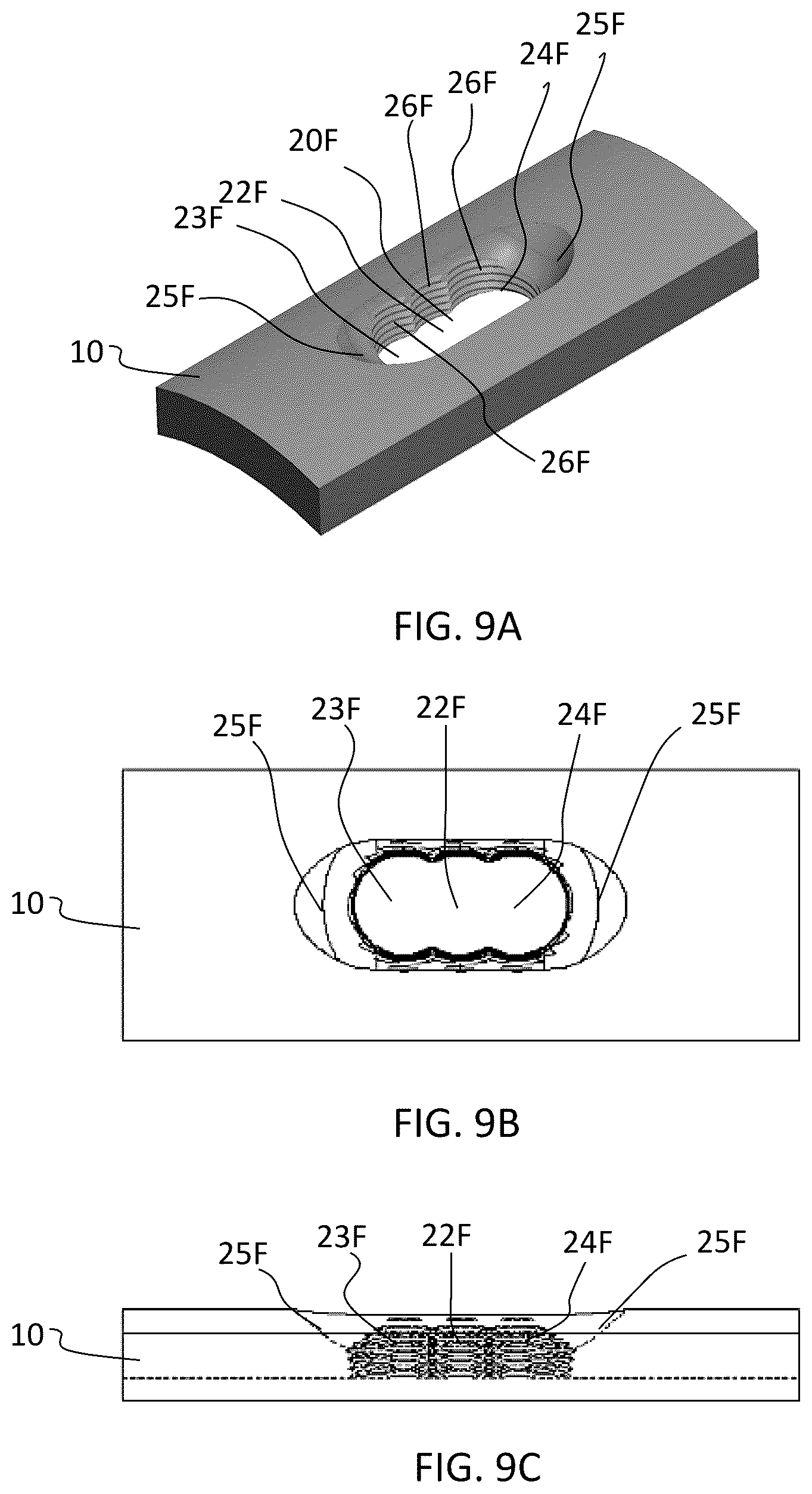 Patent US12588937 Figure 11 – Volar distal radius stabilization system