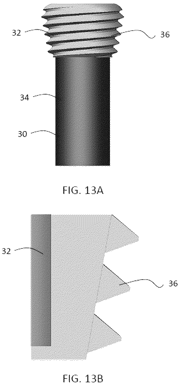 Patent US12588937 Figure 16 – Volar distal radius stabilization system