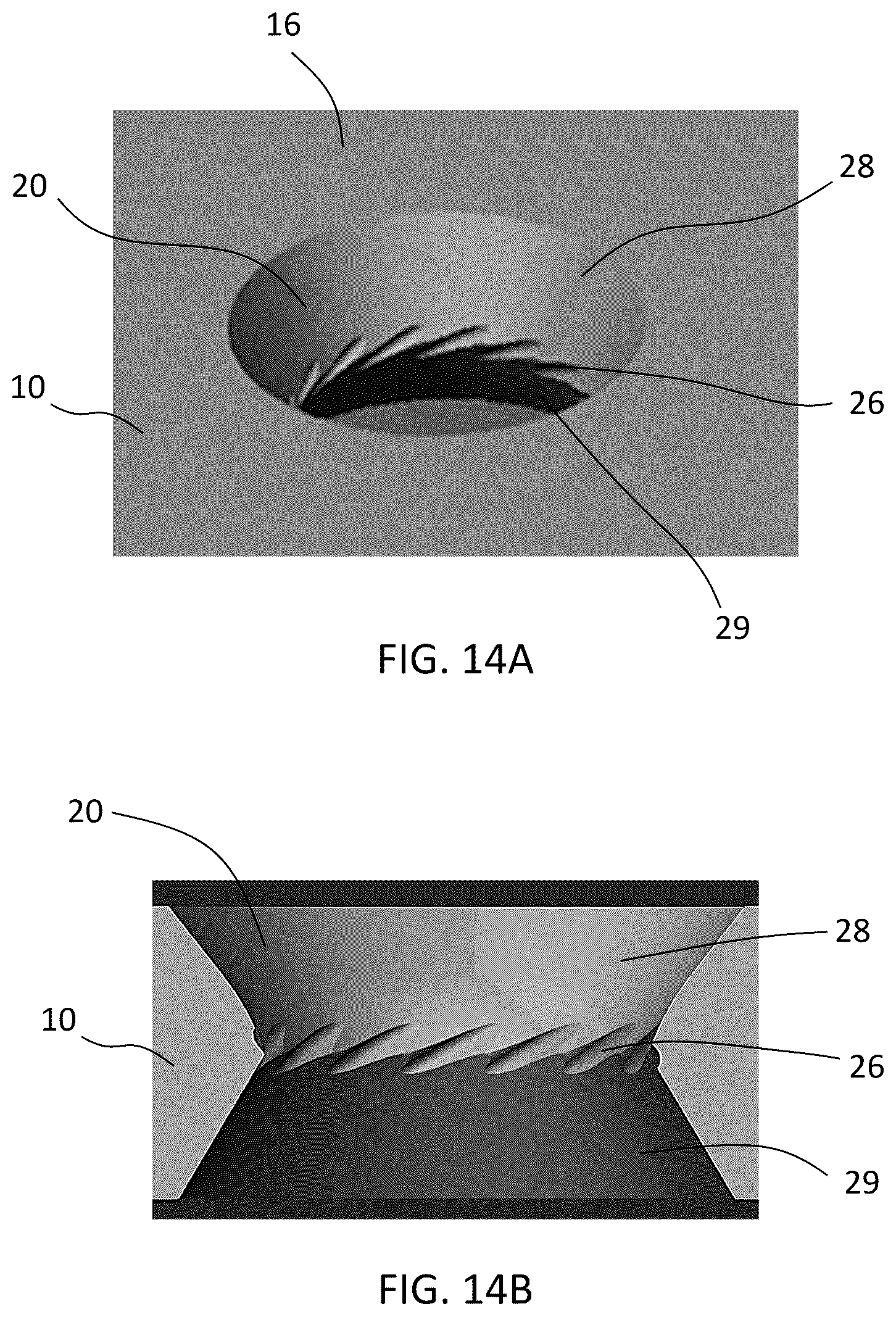 Patent US12588937 Figure 17 – Volar distal radius stabilization system