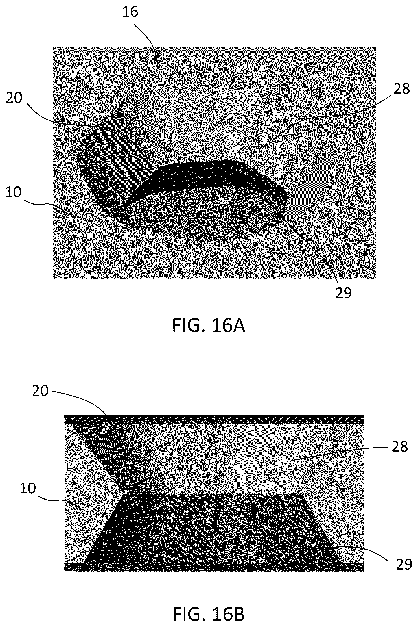 Patent US12588937 Figure 19 – Volar distal radius stabilization system