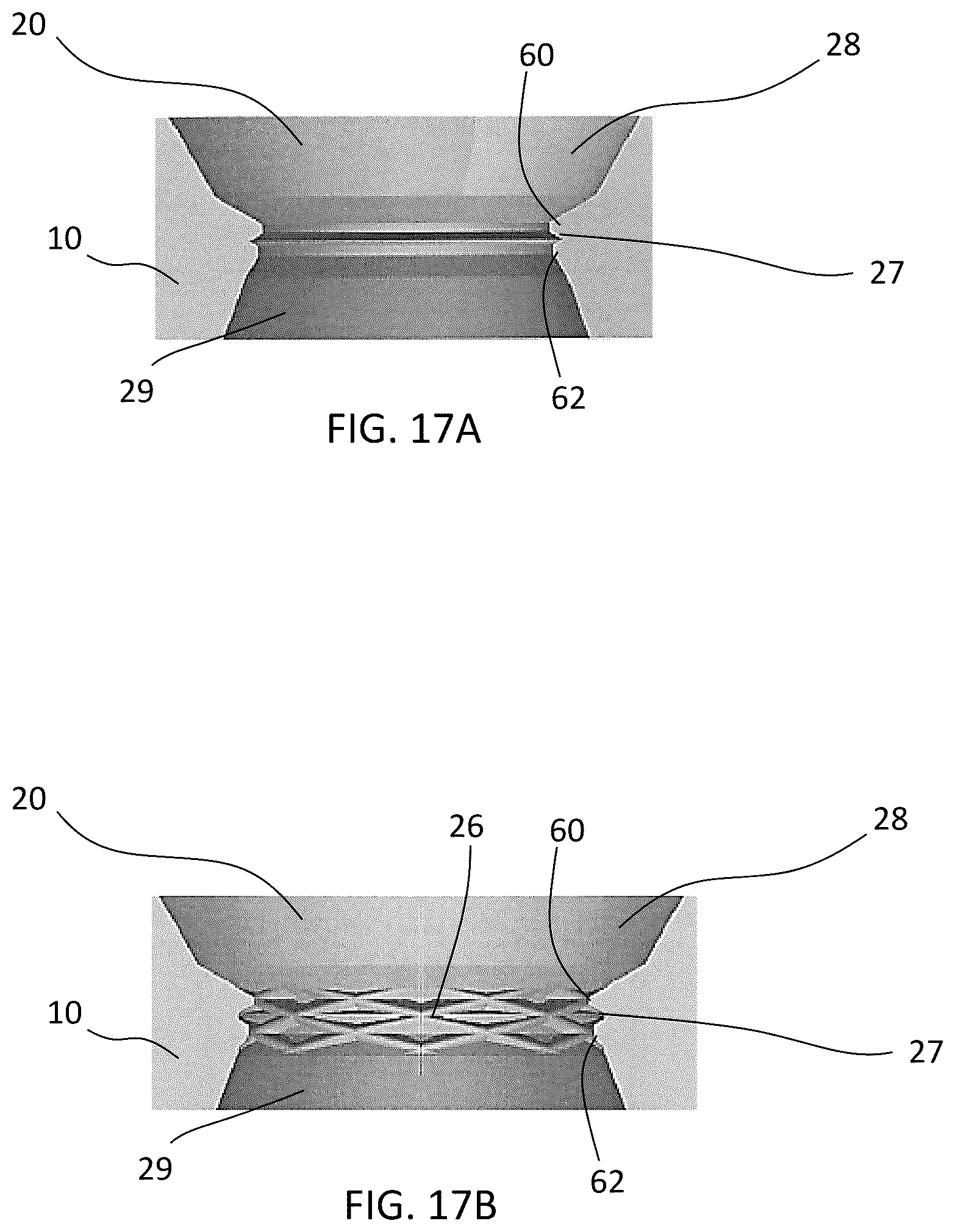 Patent US12588937 Figure 20 – Volar distal radius stabilization system