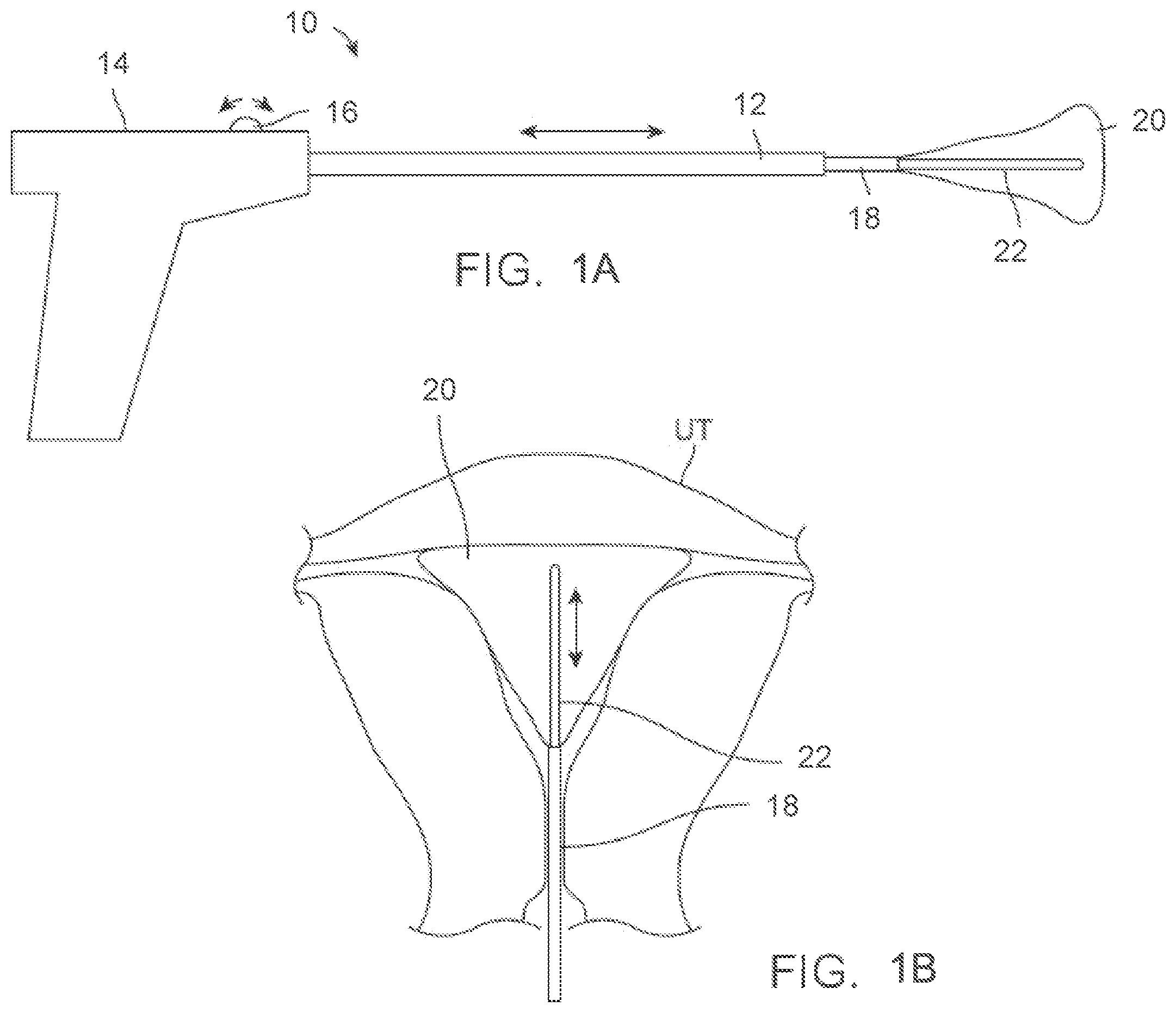 Patent US12588939 Figure 1 – Apparatus and methods for regulating cryogenic treatment