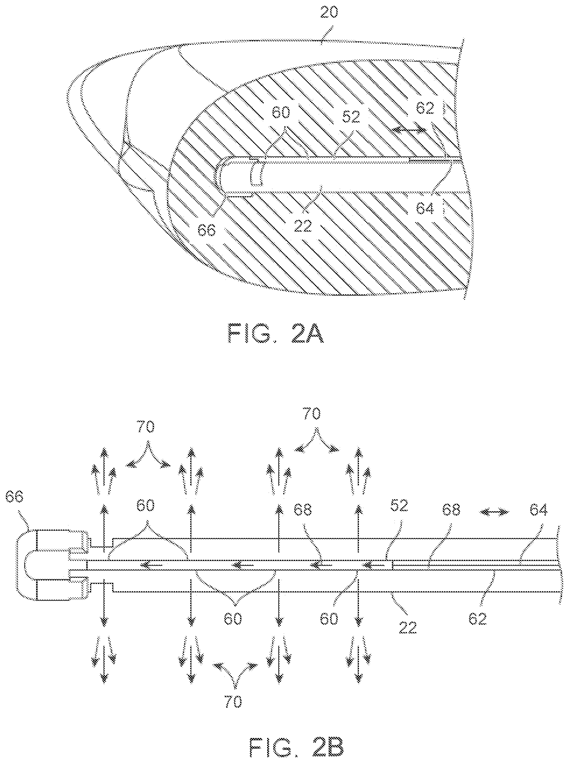 Patent US12588939 Figure 6 – Apparatus and methods for regulating cryogenic treatment
