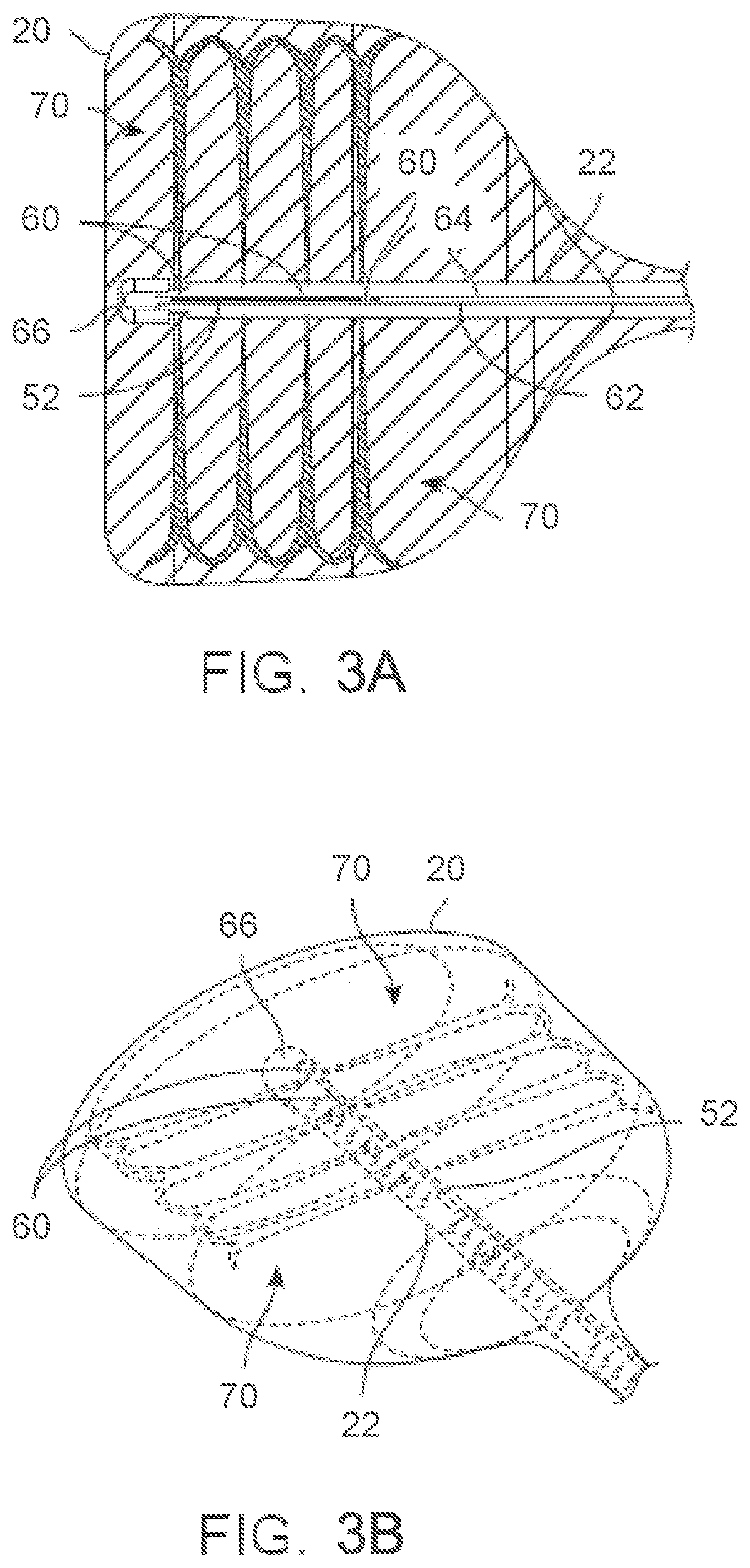 Patent US12588939 Figure 7 – Apparatus and methods for regulating cryogenic treatment