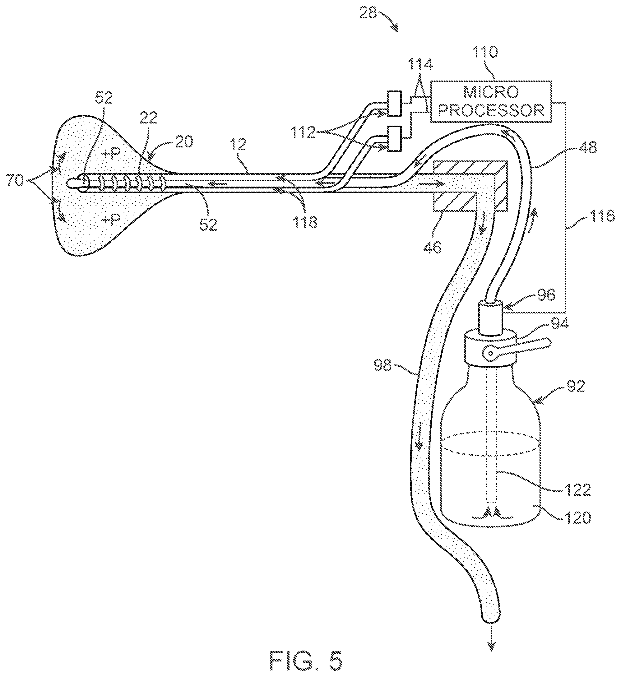 Patent US12588939 Figure 10 – Apparatus and methods for regulating cryogenic treatment