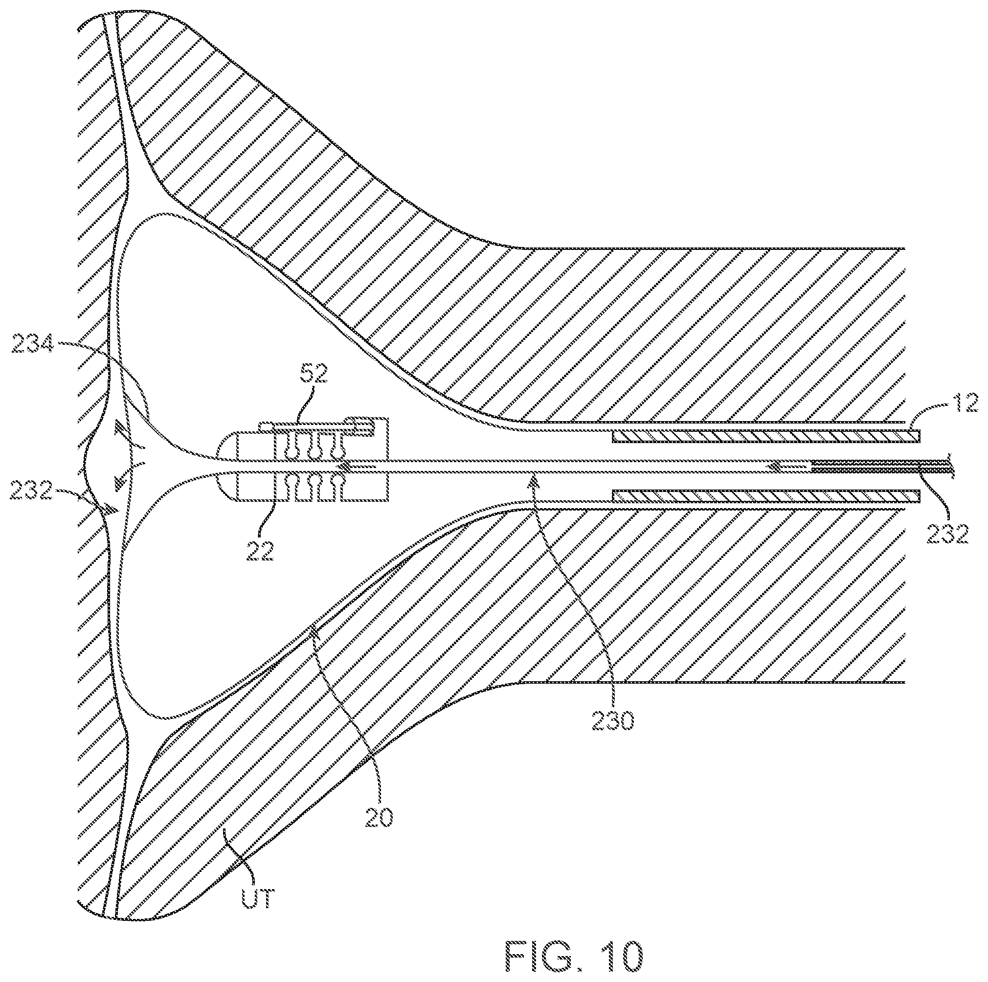 Patent US12588939 Figure 15 – Apparatus and methods for regulating cryogenic treatment