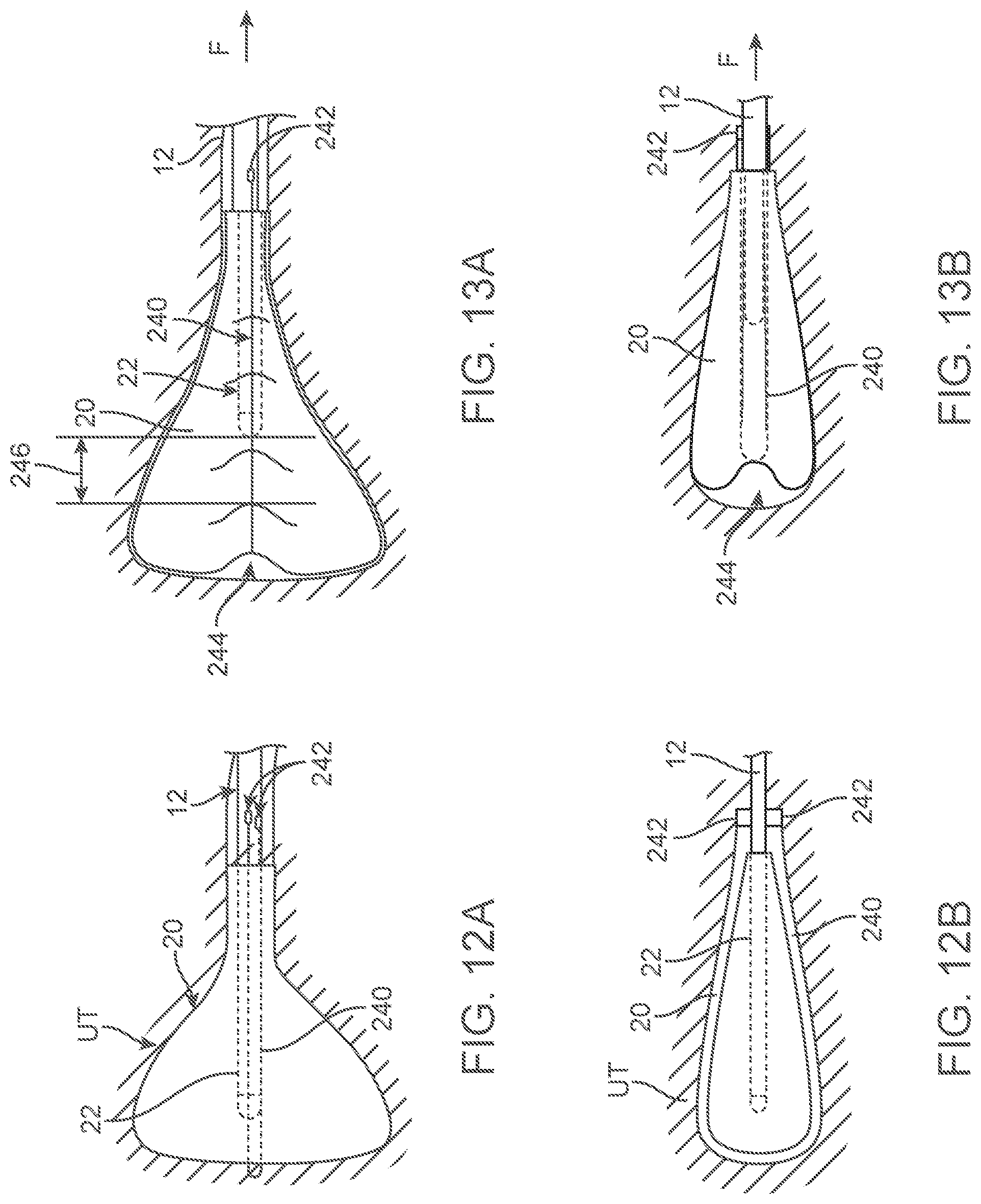 Patent US12588939 Figure 17 – Apparatus and methods for regulating cryogenic treatment