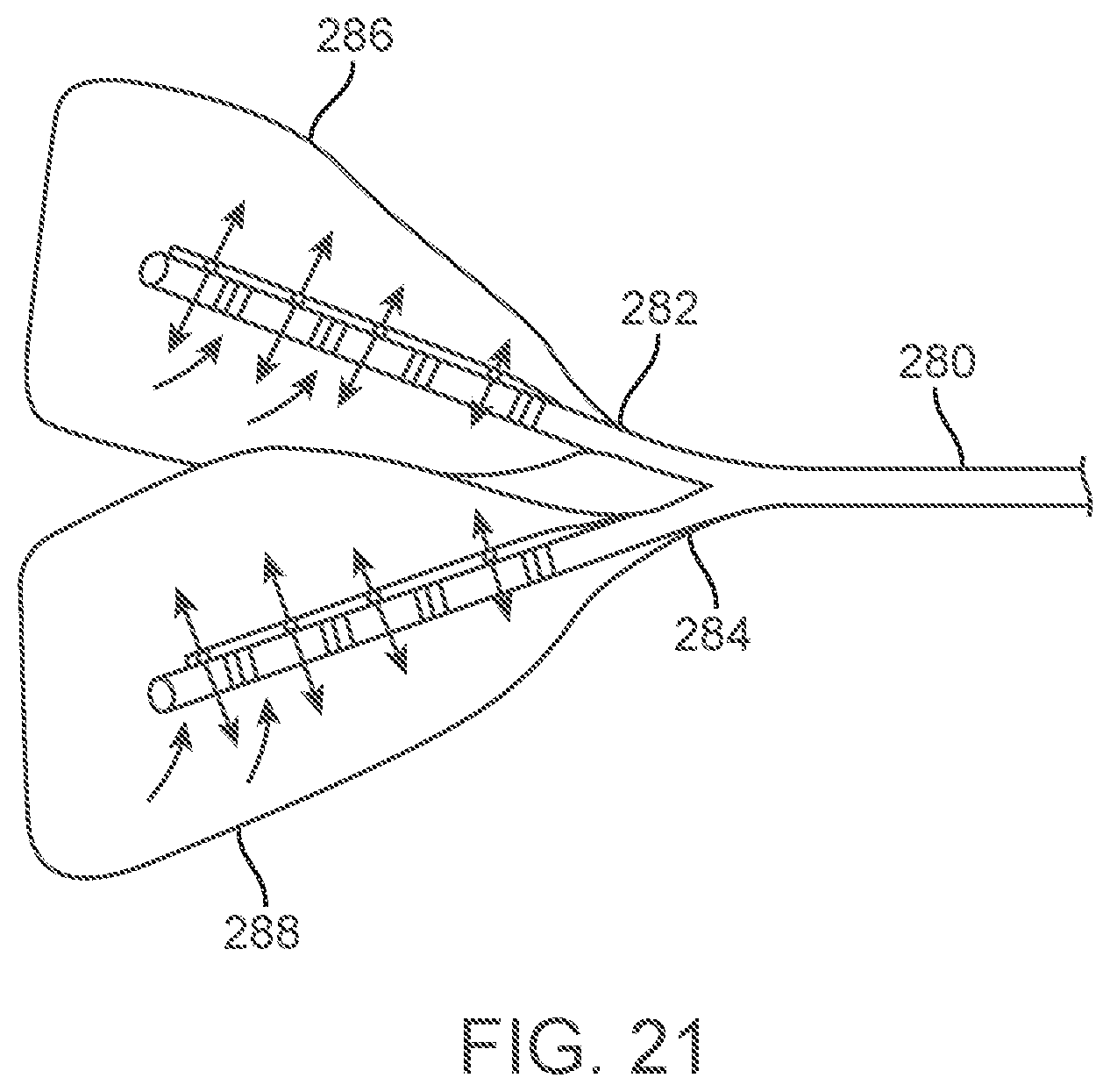 Patent US12588939 Figure 20 – Apparatus and methods for regulating cryogenic treatment