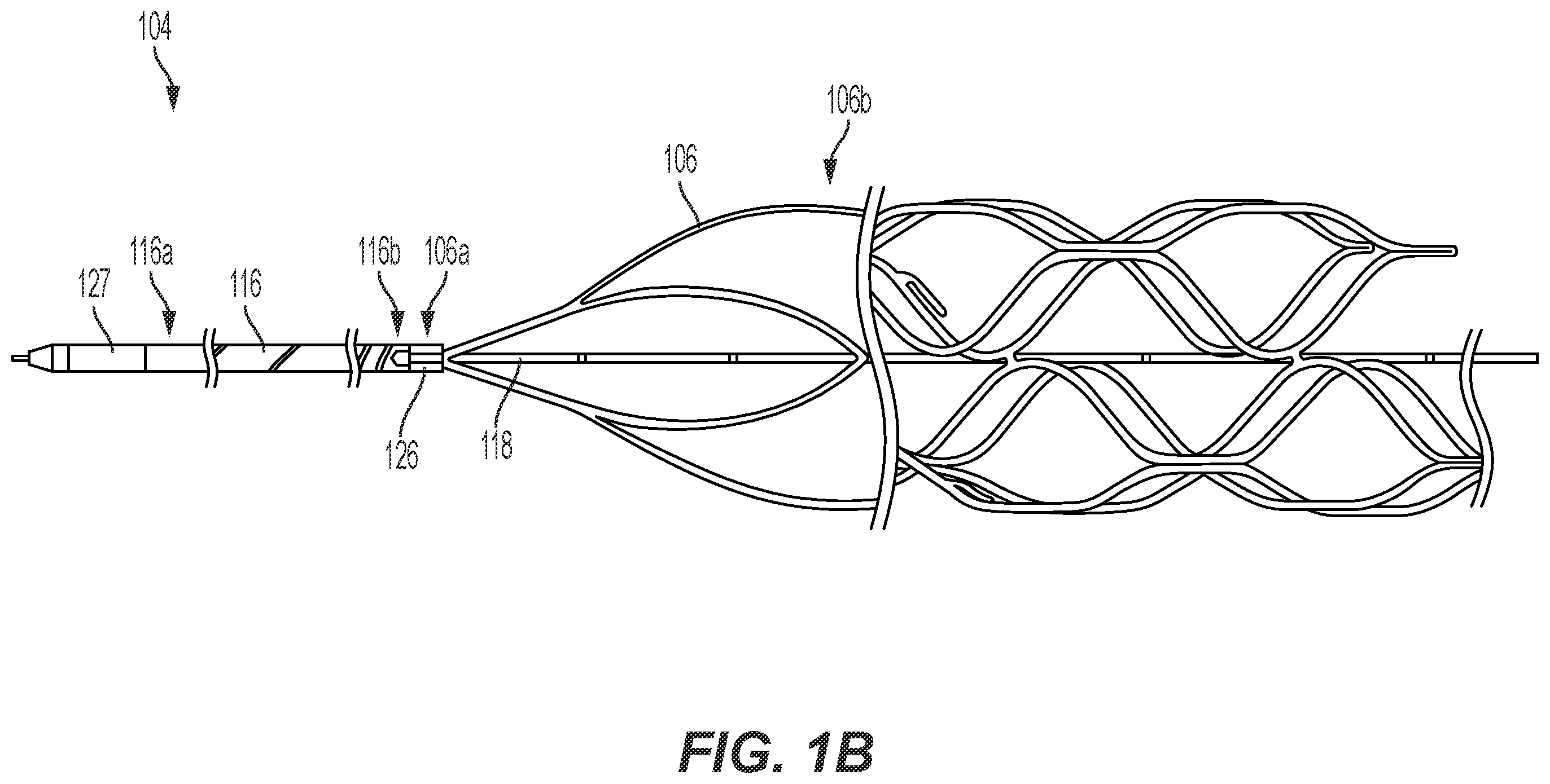Patent US12588943 Figure 2 – Electrically enhanced retrieval of material from vessel lumens
