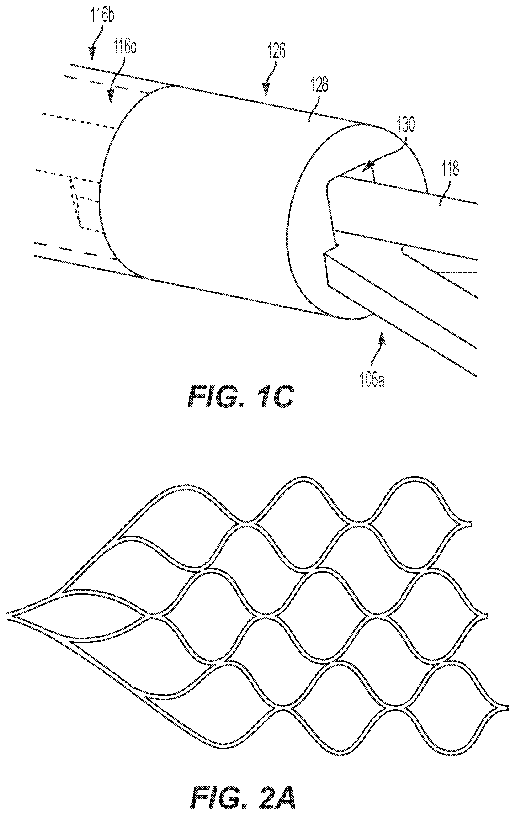Patent US12588943 Figure 3 – Electrically enhanced retrieval of material from vessel lumens