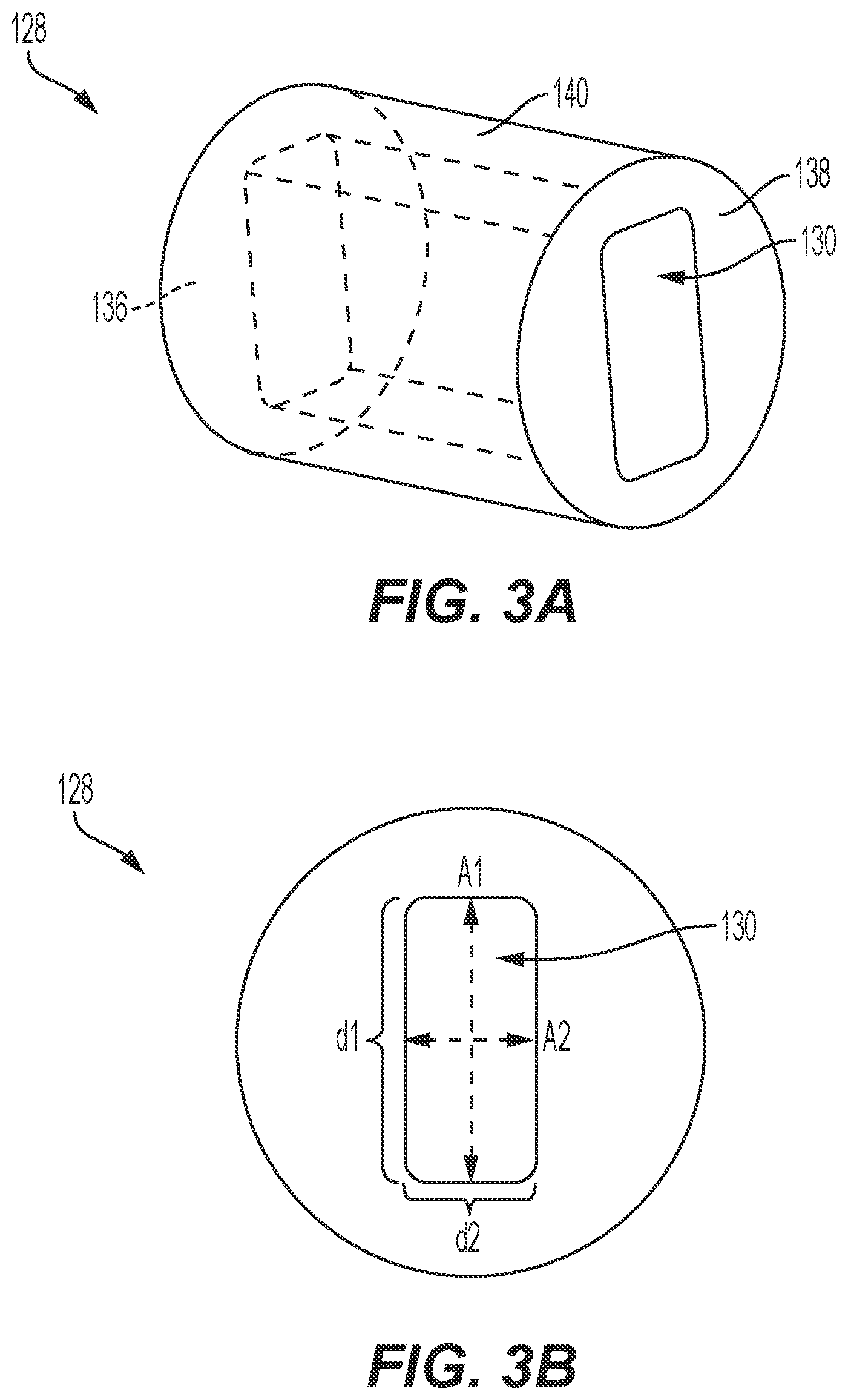 Patent US12588943 Figure 5 – Electrically enhanced retrieval of material from vessel lumens