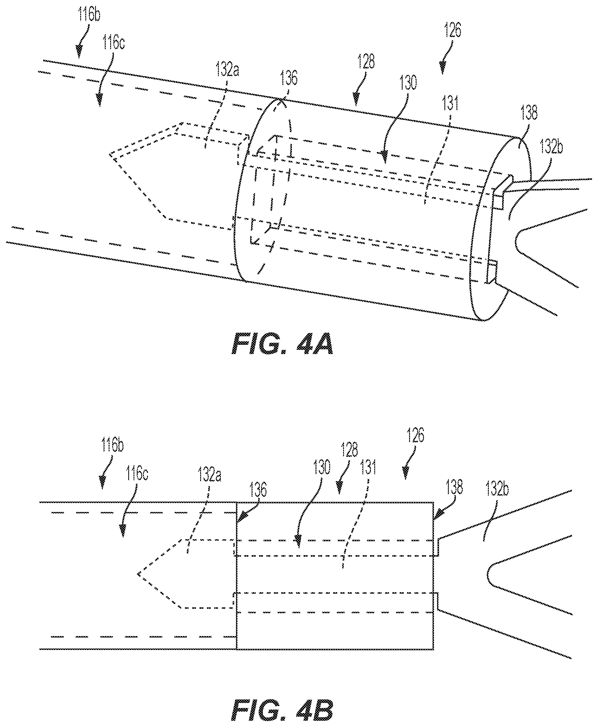 Patent US12588943 Figure 6 – Electrically enhanced retrieval of material from vessel lumens