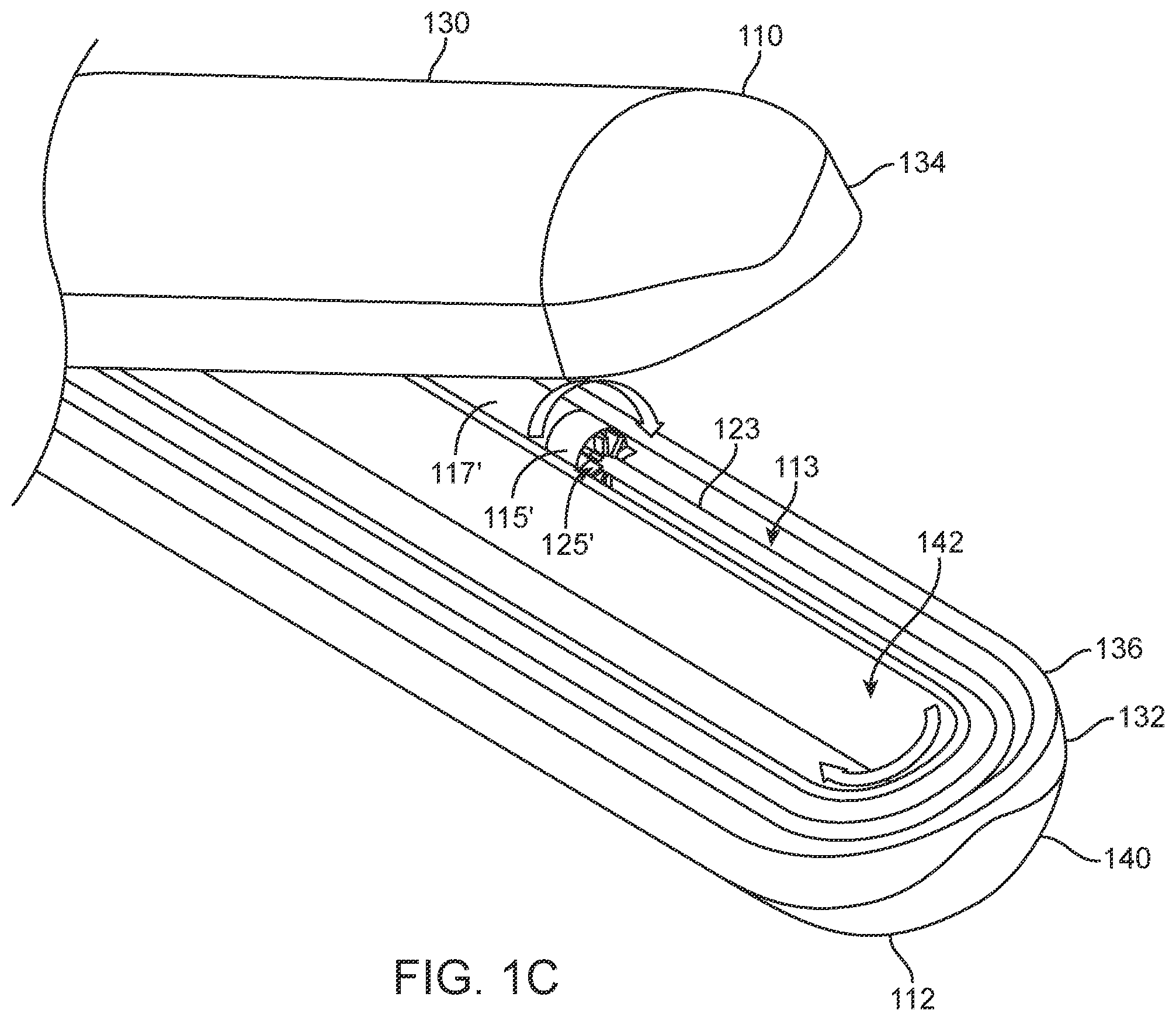 Patent US12588945 Figure 3 – Devices and methods for preparing a valve for a transcatheter valve replacement procedure