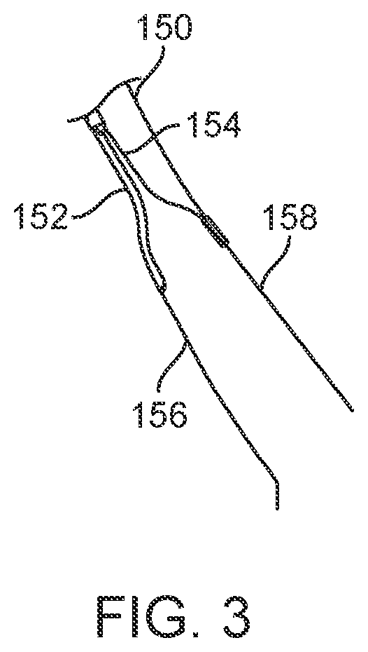 Patent US12588945 Figure 5 – Devices and methods for preparing a valve for a transcatheter valve replacement procedure