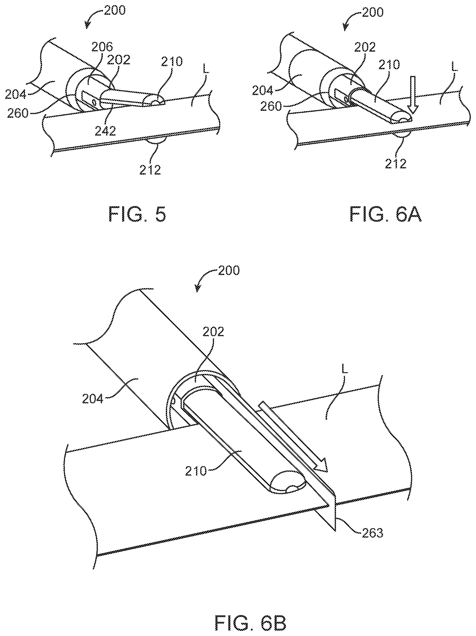 Patent US12588945 Figure 7 – Devices and methods for preparing a valve for a transcatheter valve replacement procedure