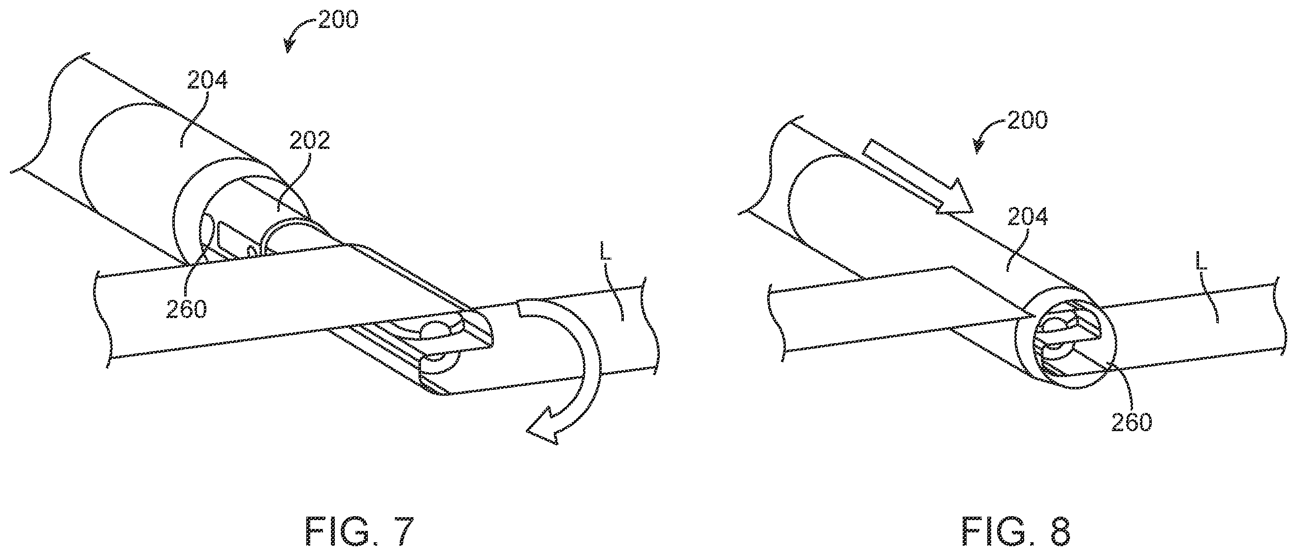Patent US12588945 Figure 8 – Devices and methods for preparing a valve for a transcatheter valve replacement procedure