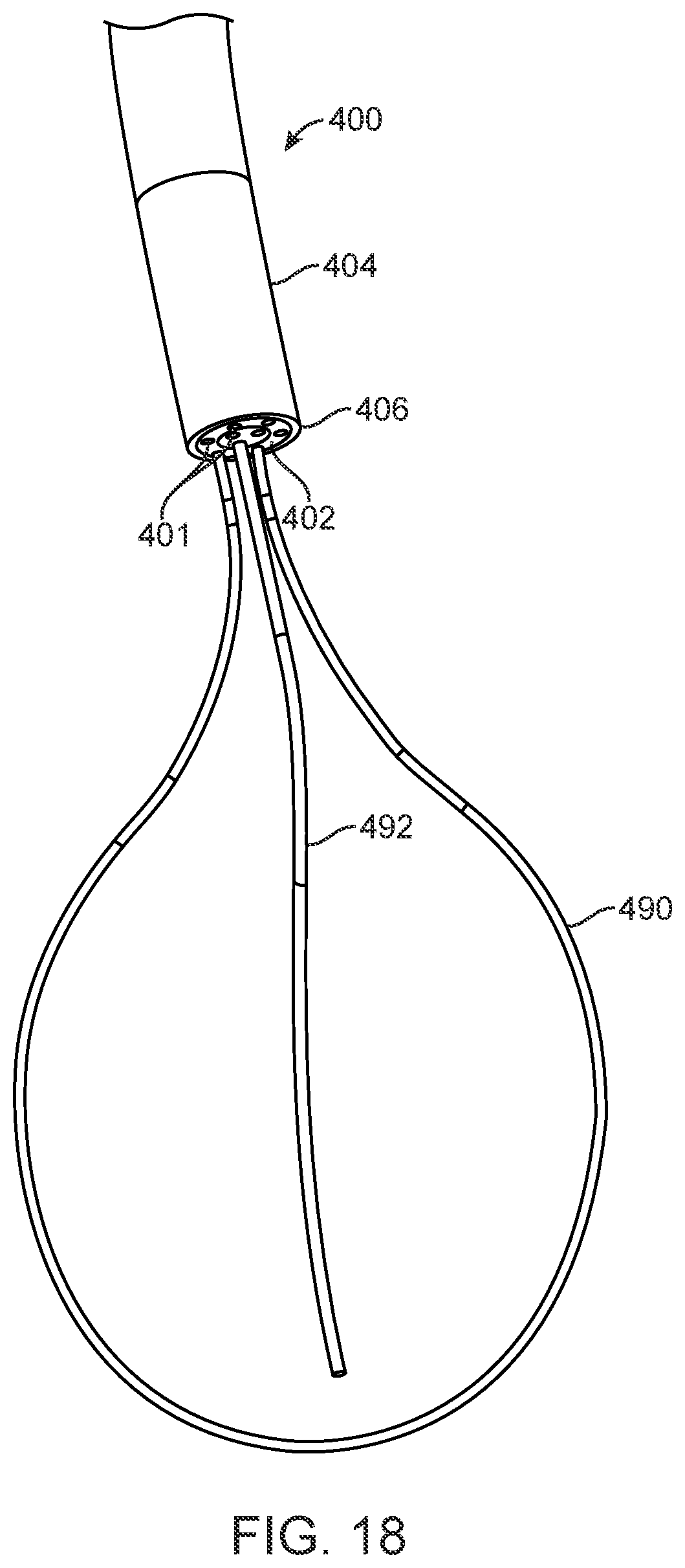 Patent US12588945 Figure 15 – Devices and methods for preparing a valve for a transcatheter valve replacement procedure