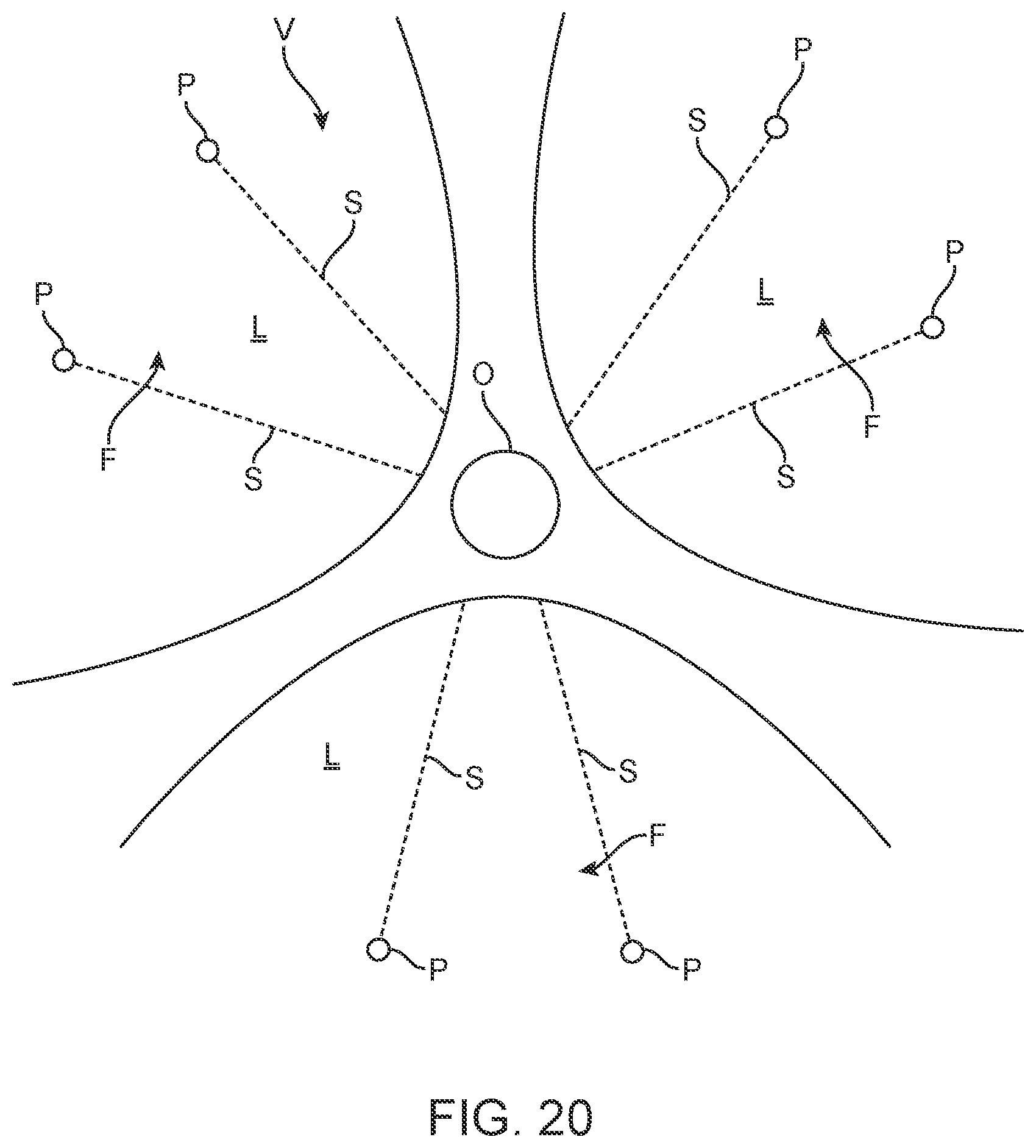 Patent US12588945 Figure 17 – Devices and methods for preparing a valve for a transcatheter valve replacement procedure