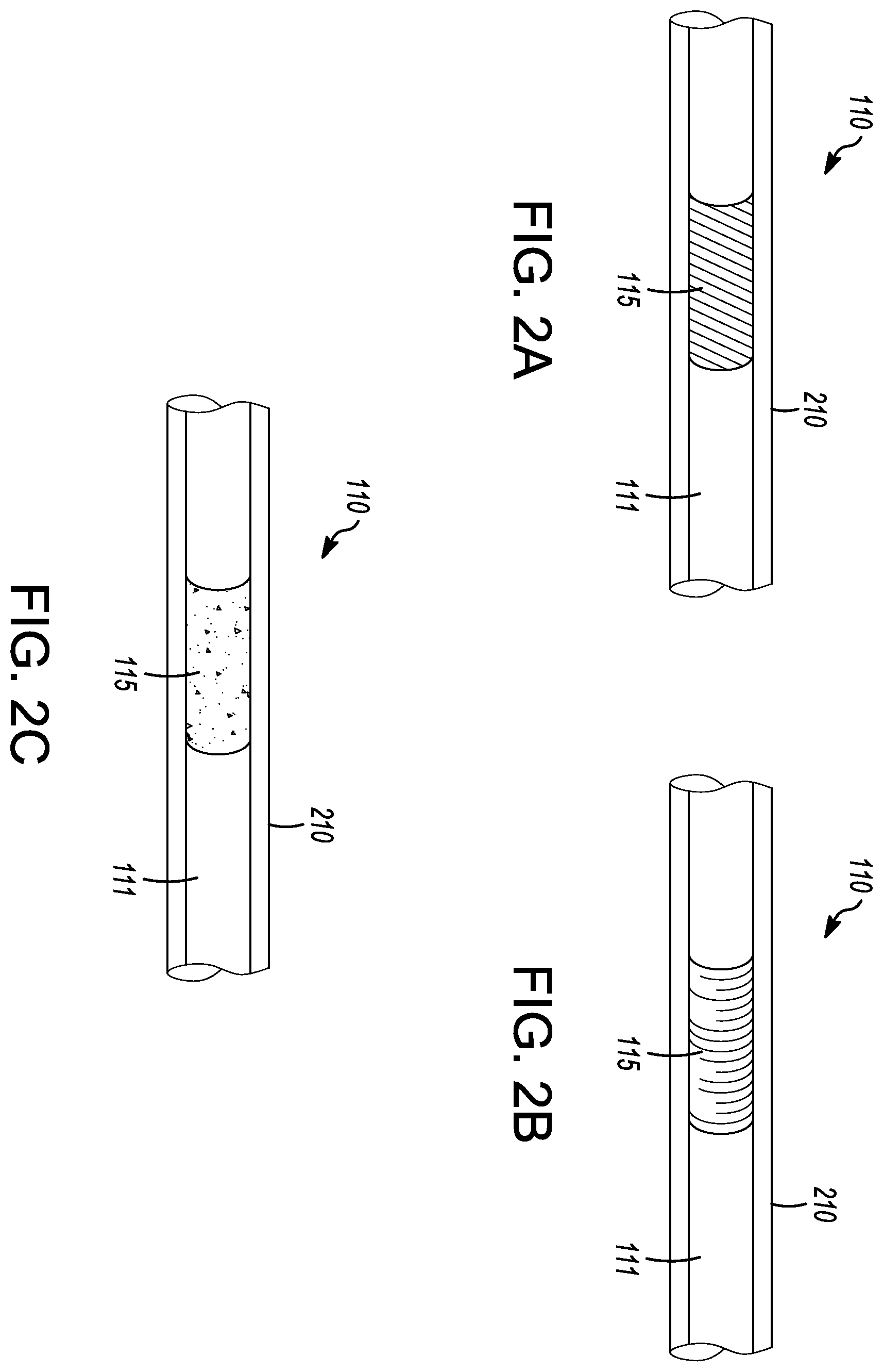 Patent US12588947 Figure 2 – Electrosurgical device with automatic shut-off
