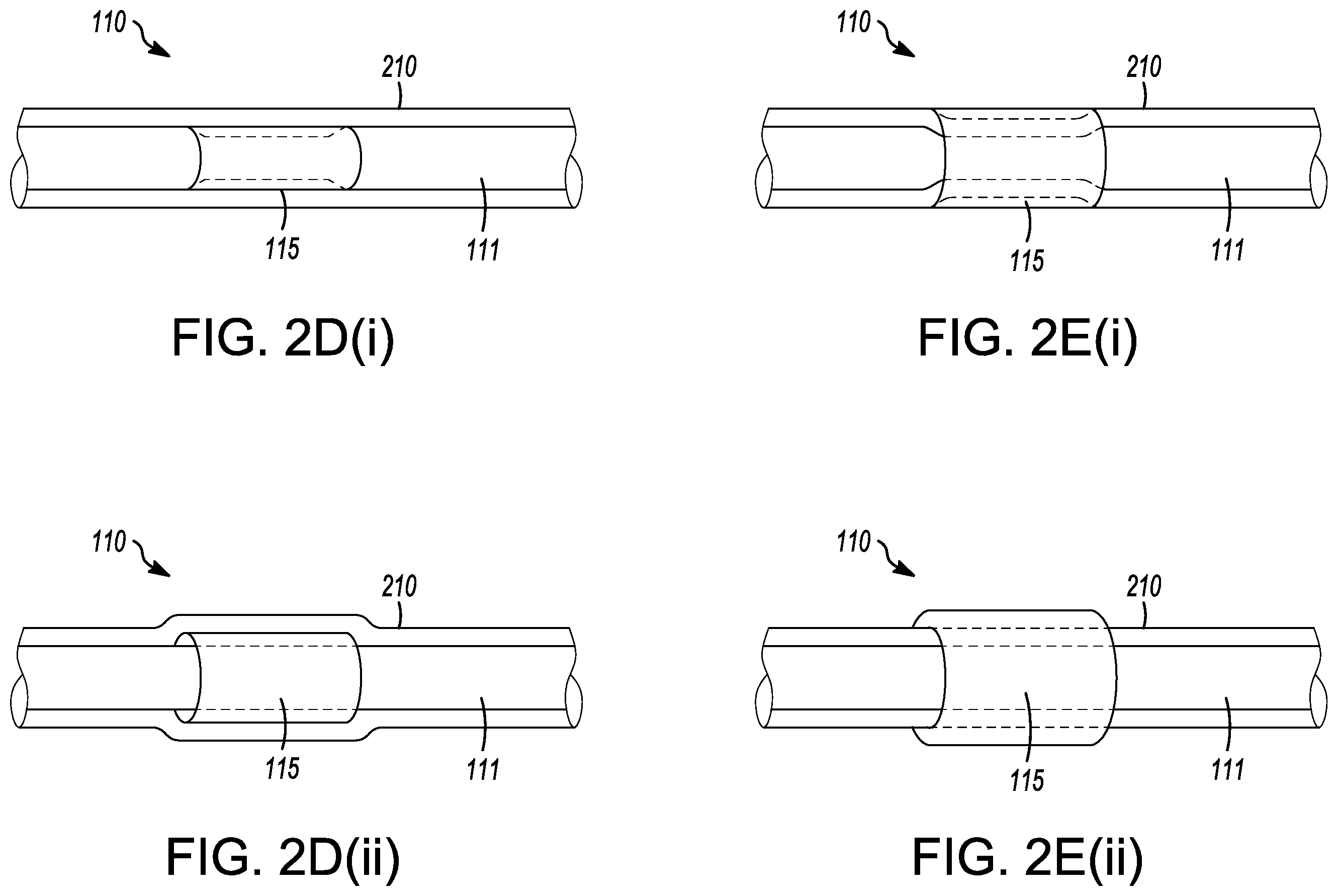 Patent US12588947 Figure 3 – Electrosurgical device with automatic shut-off