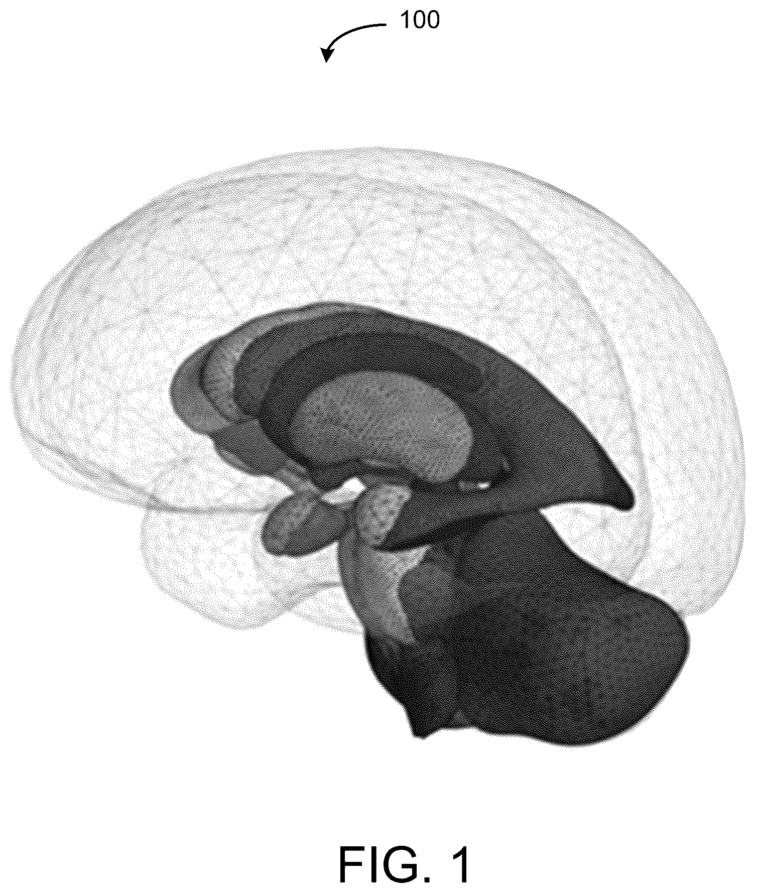 Patent US12588950 Figure 1 – Trajectory planning for minimally invasive therapy delivery using local mesh geometry