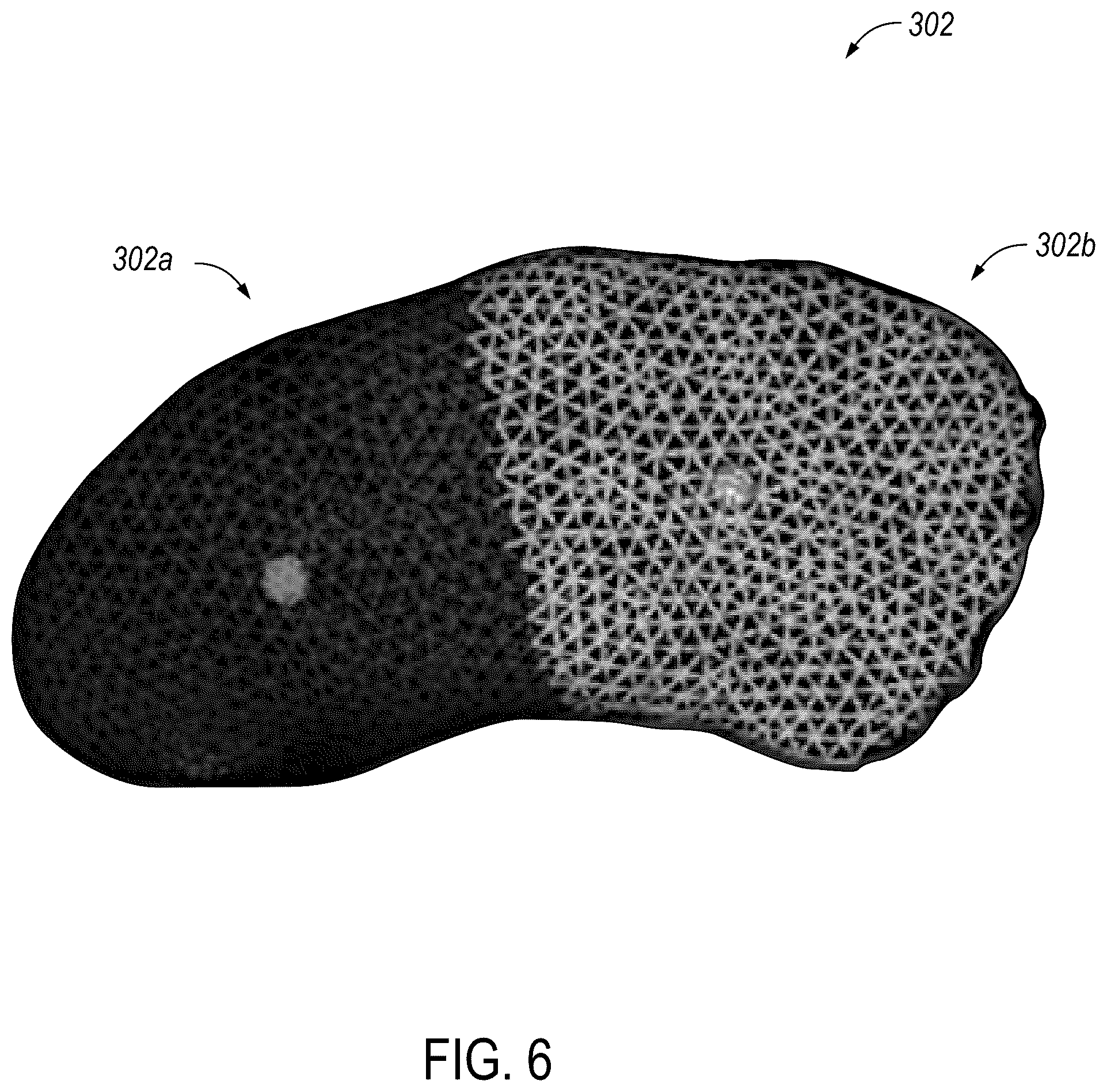 Patent US12588950 Figure 6 – Trajectory planning for minimally invasive therapy delivery using local mesh geometry