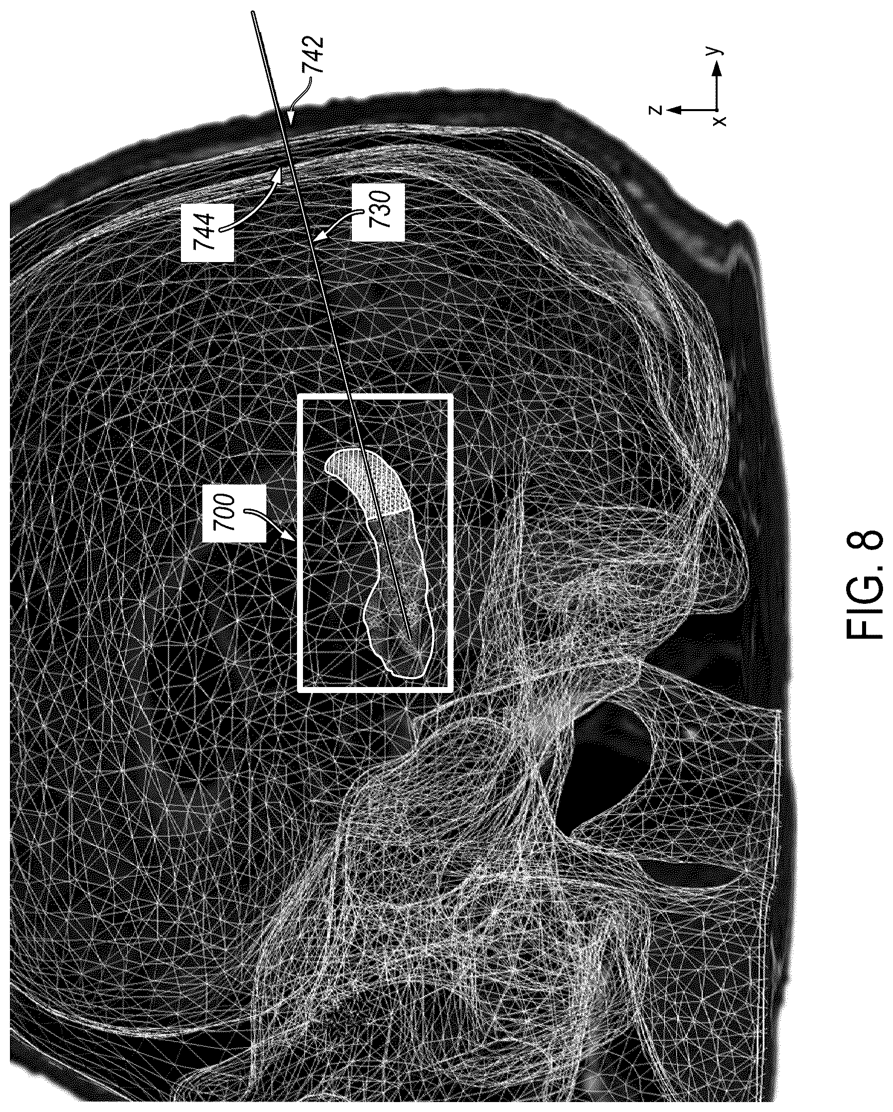 Patent US12588950 Figure 8 – Trajectory planning for minimally invasive therapy delivery using local mesh geometry