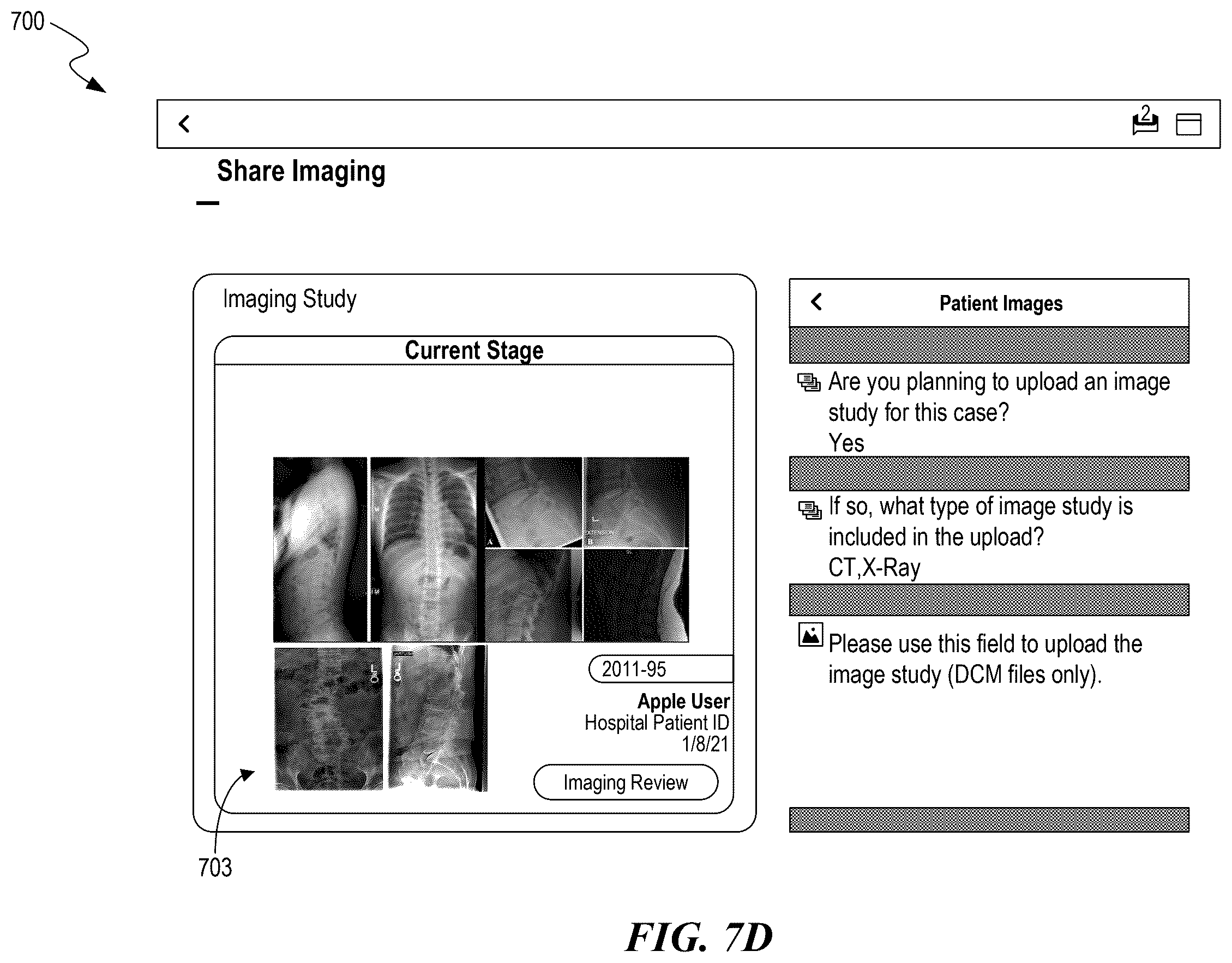 Patent US12588951 Figure 11 – Patient-specific implant design and manufacturing system with a surgical implant positioning manager
