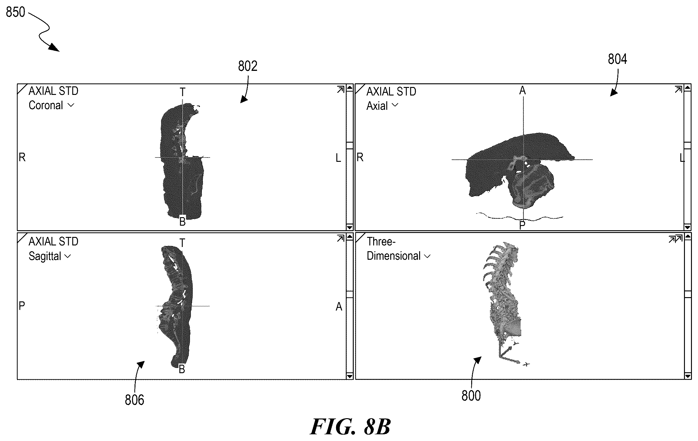 Patent US12588951 Figure 13 – Patient-specific implant design and manufacturing system with a surgical implant positioning manager