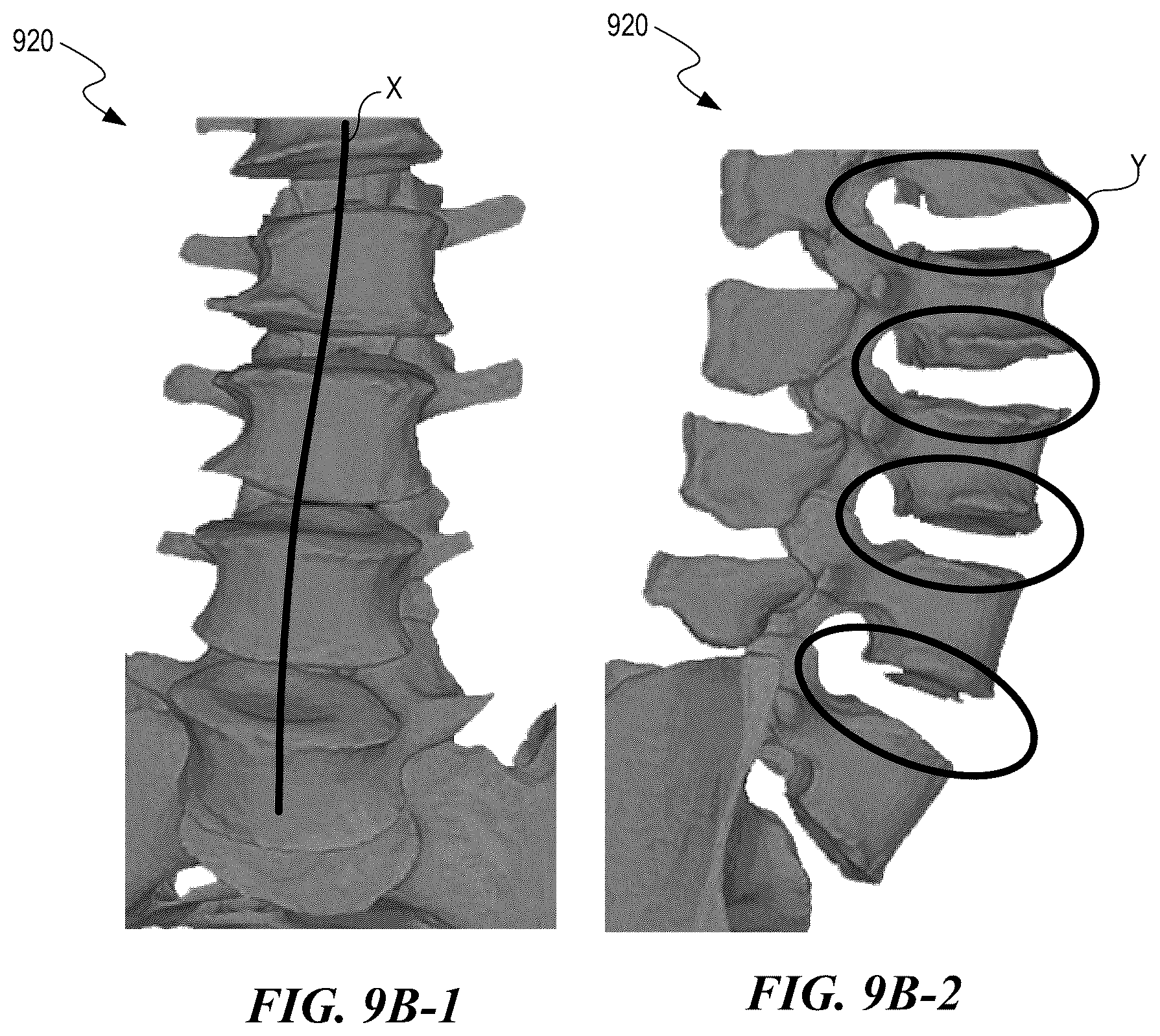 Patent US12588951 Figure 15 – Patient-specific implant design and manufacturing system with a surgical implant positioning manager