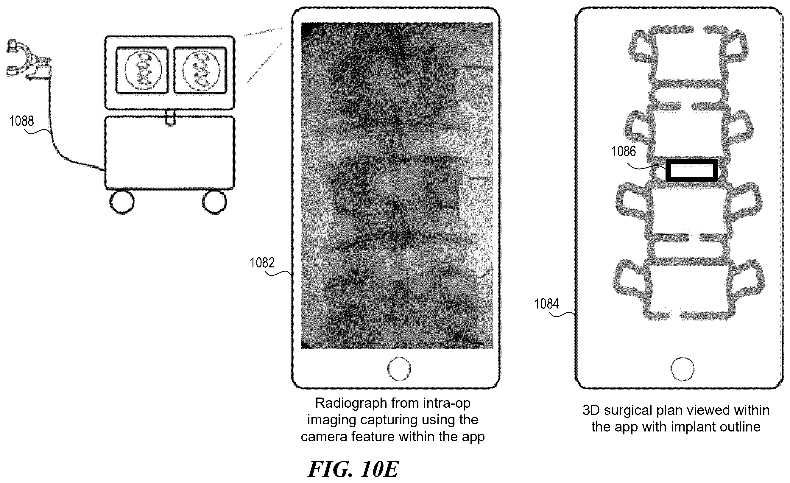 Patent US12588951 Figure 20 – Patient-specific implant design and manufacturing system with a surgical implant positioning manager